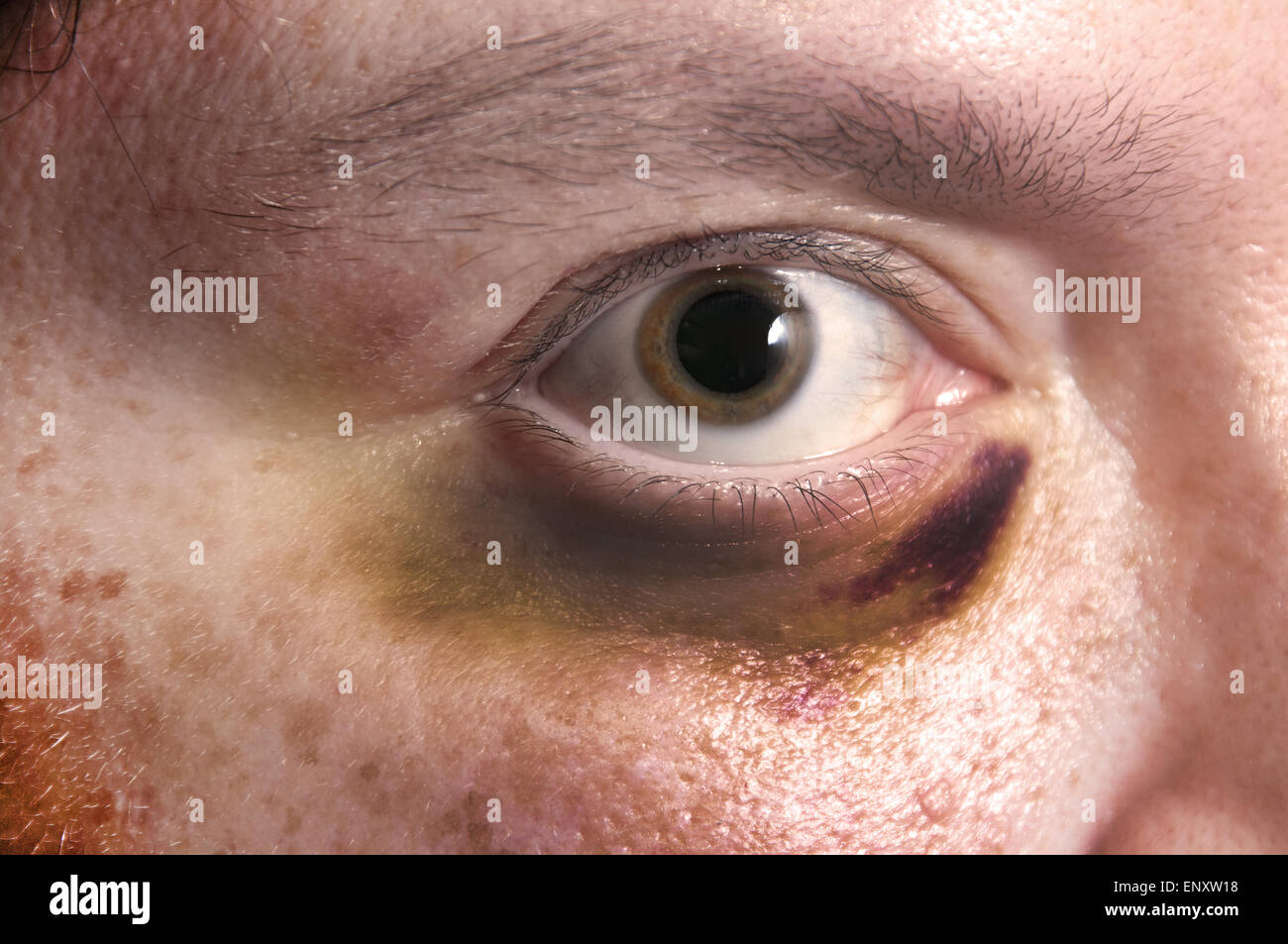 Blaues Auge Stockfoto