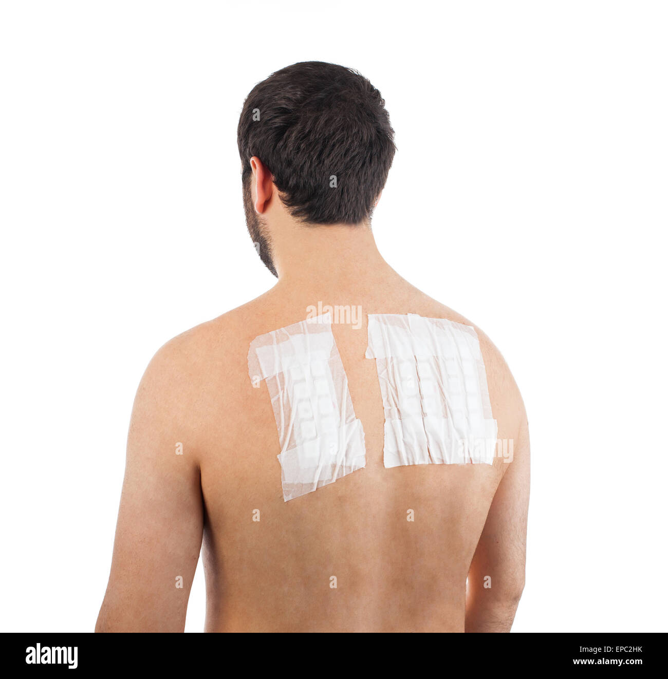 Haut Allergie Epikutantest auf Rückseite des männlichen Patienten auf weißem Hintergrund Stockfoto
