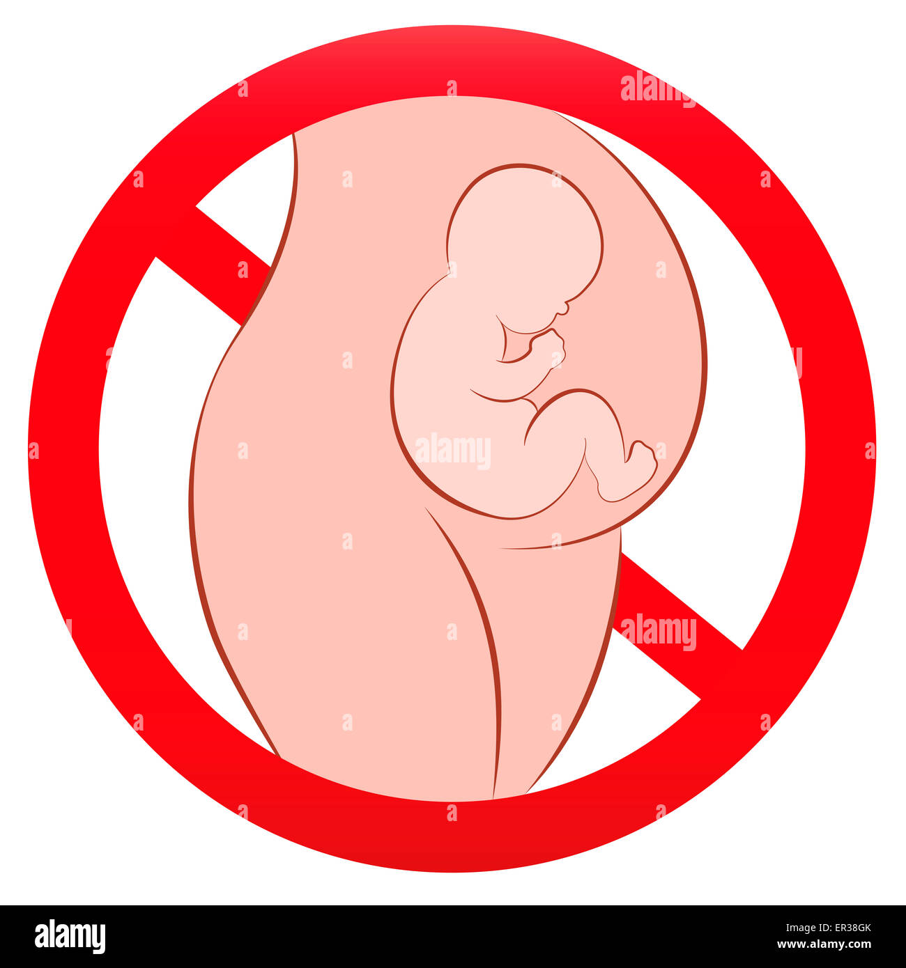 Warnschild zur Schwangerschaft. Abbildung auf weißem Hintergrund. Stockfoto
