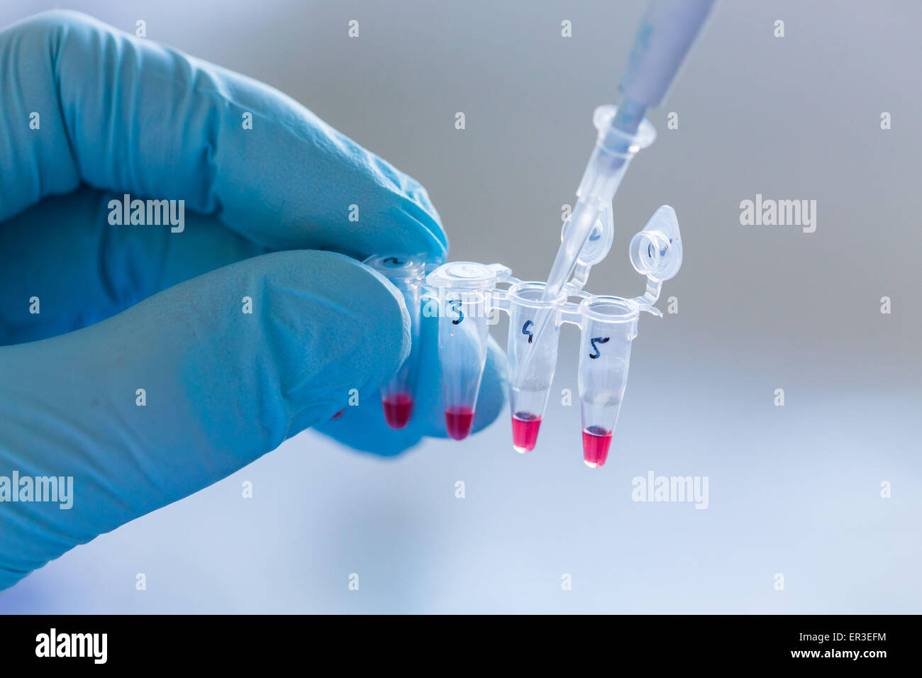 Forschung in Biochemie und molekulare Genetik, Techniker mit einer Pipette, um Proteine aus einem Fläschchen auf eine Gel-Elektrophorese-Einheit zu übertragen. Stockfoto