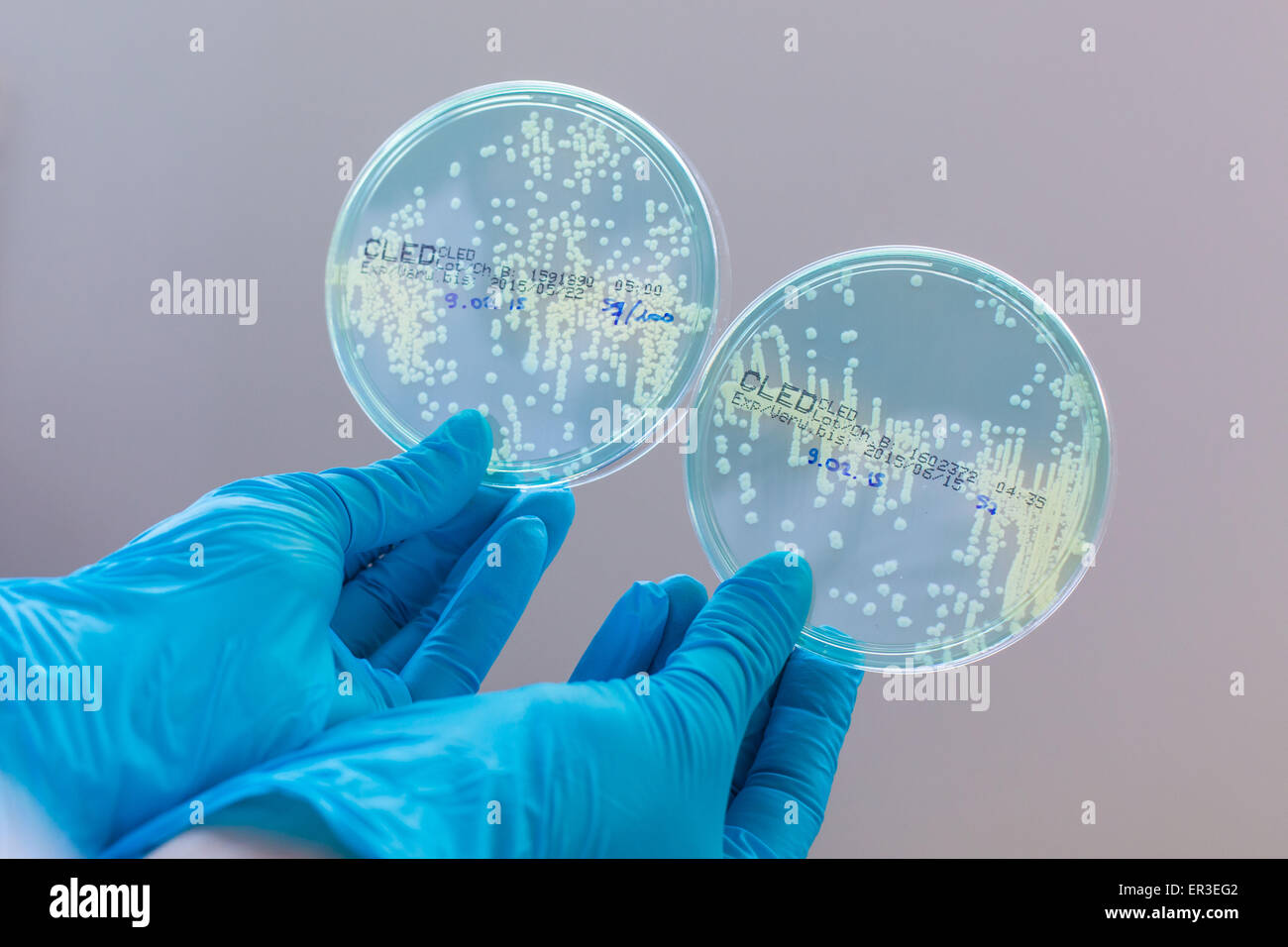 Hände halten eine Kultur-Platte, die Prüfung auf das Vorhandensein von Escherichia-coli-Bakterien durch Antibiotika-Resistenz zu betrachten. Stockfoto