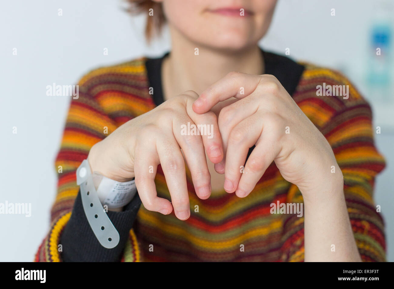 Hände einer Frau mit rheumatoider Arthritis. Stockfoto