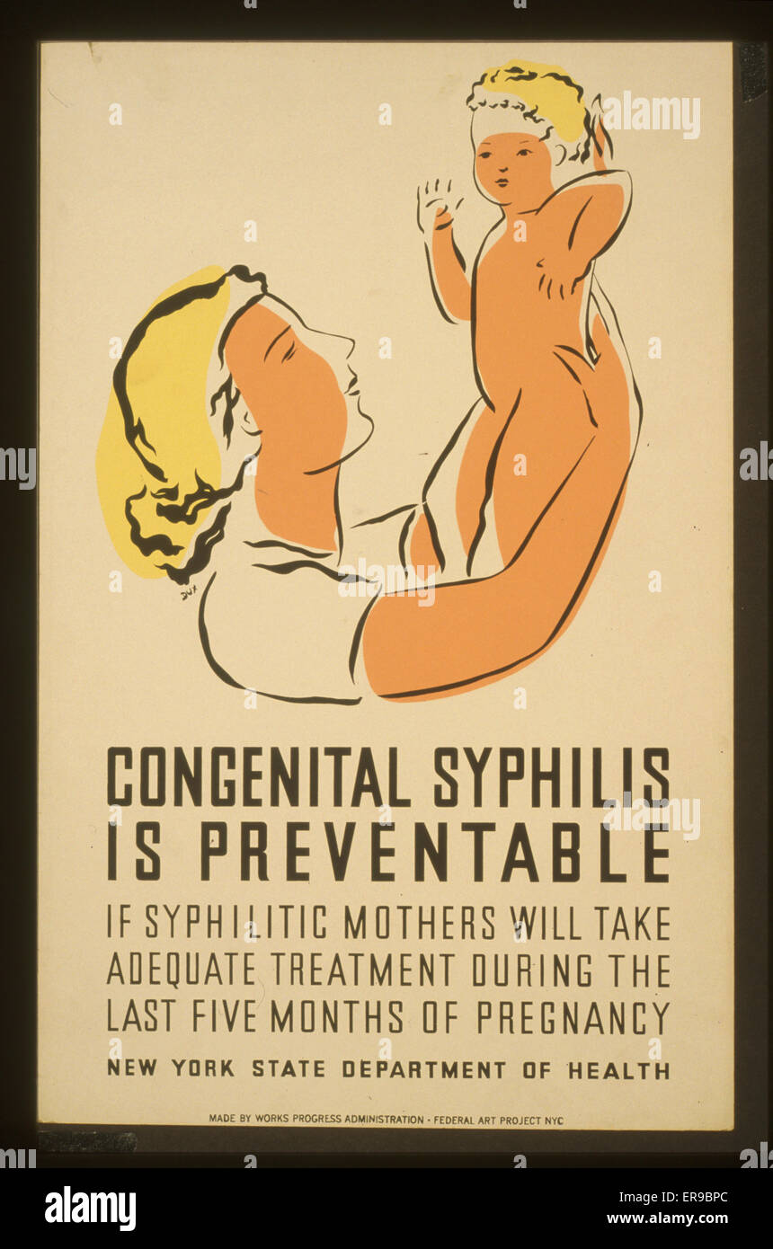 Angeborene Syphilis ist vermeidbar, wenn syphilitische Mütter werden Stockfoto