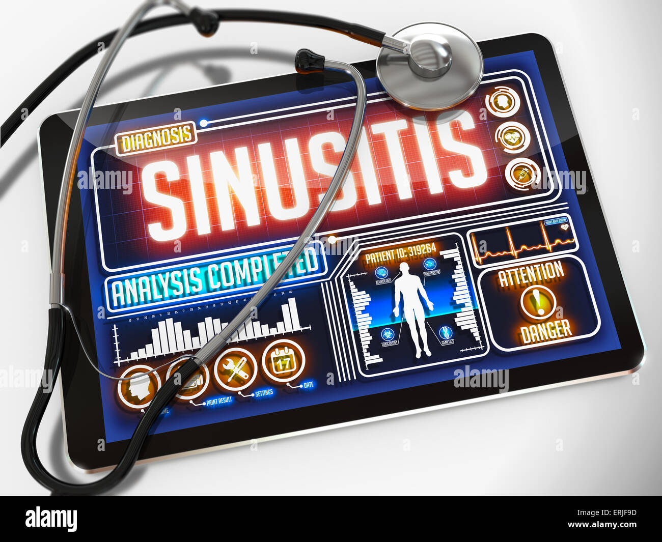 Auf dem Display des medizinischen Tablette Sinusitis. Stockfoto