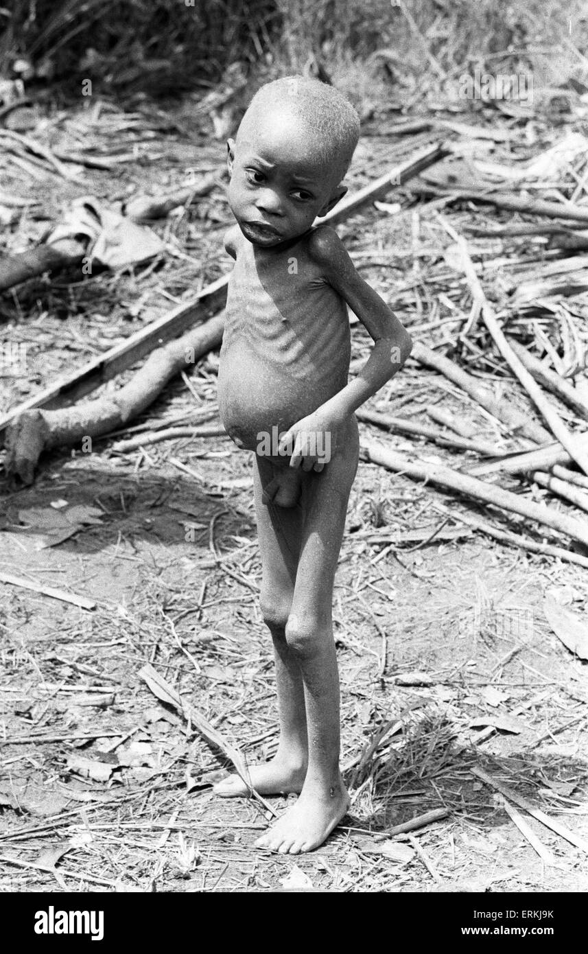 Opfer des nigerianischen Bürgerkrieges, auch bekannt als der nigerianischen Biafra-Krieges. Juli 1968. Stockfoto