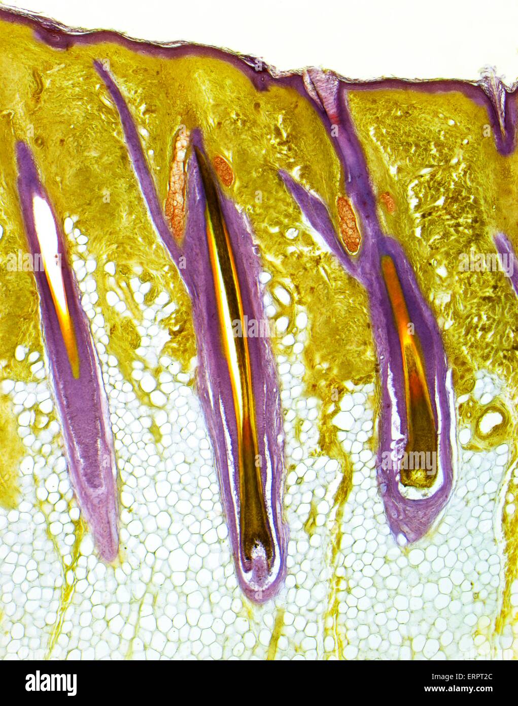 Behaarte Haut. Leichte Schliffbild eines dicken Abschnitts der menschlichen Haut, zeigen drei zentrale Haarfollikel. Die äußere Schicht der Haut, die Epidermis ist die dünne, lila Band, unterstützt durch die tiefere, gelb, Dermis. Darunter ist die subkutane Schicht der Verbindung Stockfoto