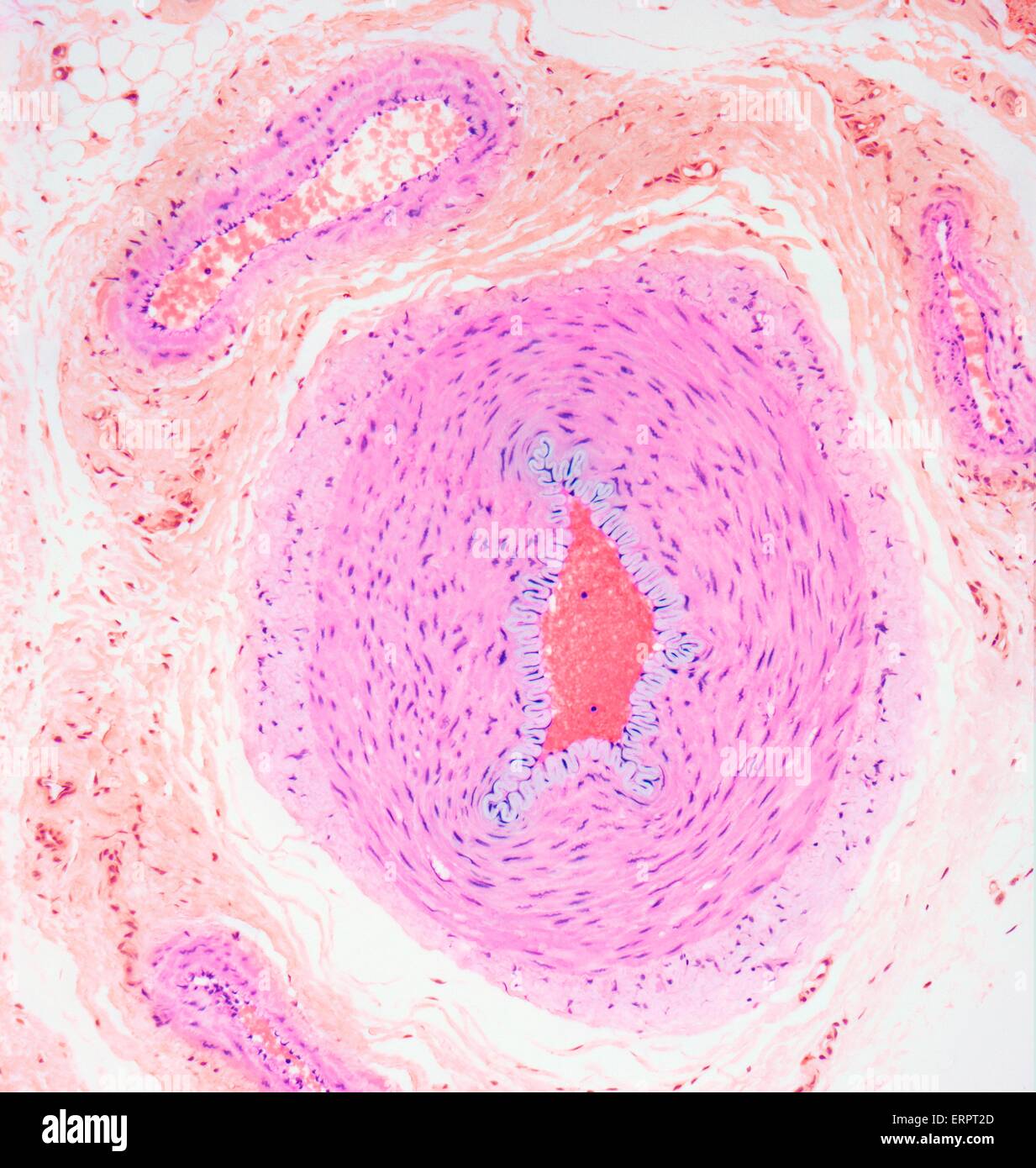 Blutgefäße. Leichte Schliffbild eines Abschnitts durch Gewebe zeigt eine Arterie (Mitte) und eine Vene (oben links). Schichten der glatten Muskulatur (rosa), sind rund um die Arterie und Vene und Bindegewebe (Orange). Arterien transportieren das Blut weg von der h Stockfoto