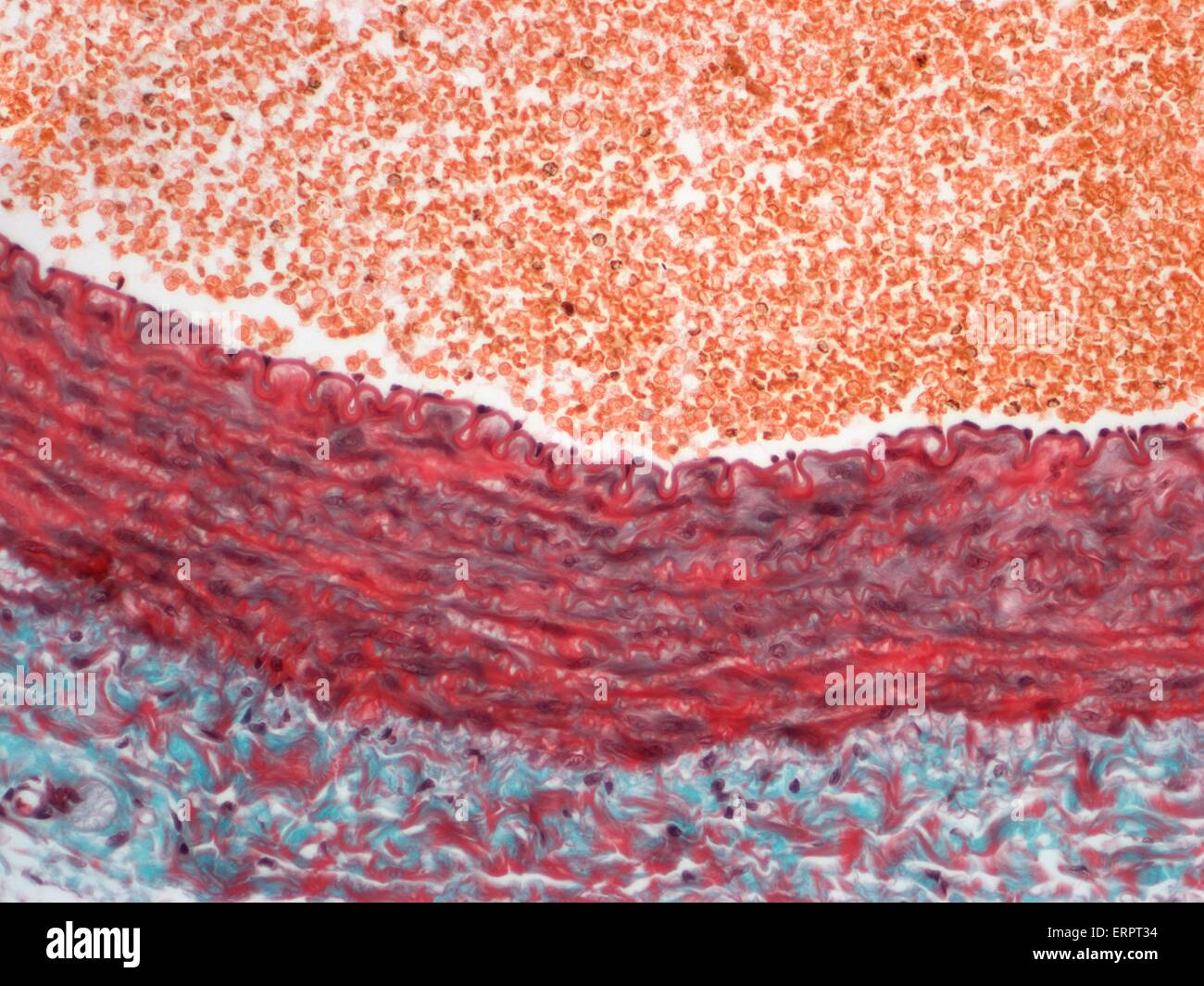 Arterie. Leichte Schliffbild eines Abschnitts einer muskulären Arterie. Dies ist die häufigste Form unter den Arterien. Ab innerste die Arterienwand entsteht durch eine interne elastische Schicht/Lamina (Bestandteil der Tunica Intima), eine breite glatte Muskelschicht (Tunica Media Stockfoto