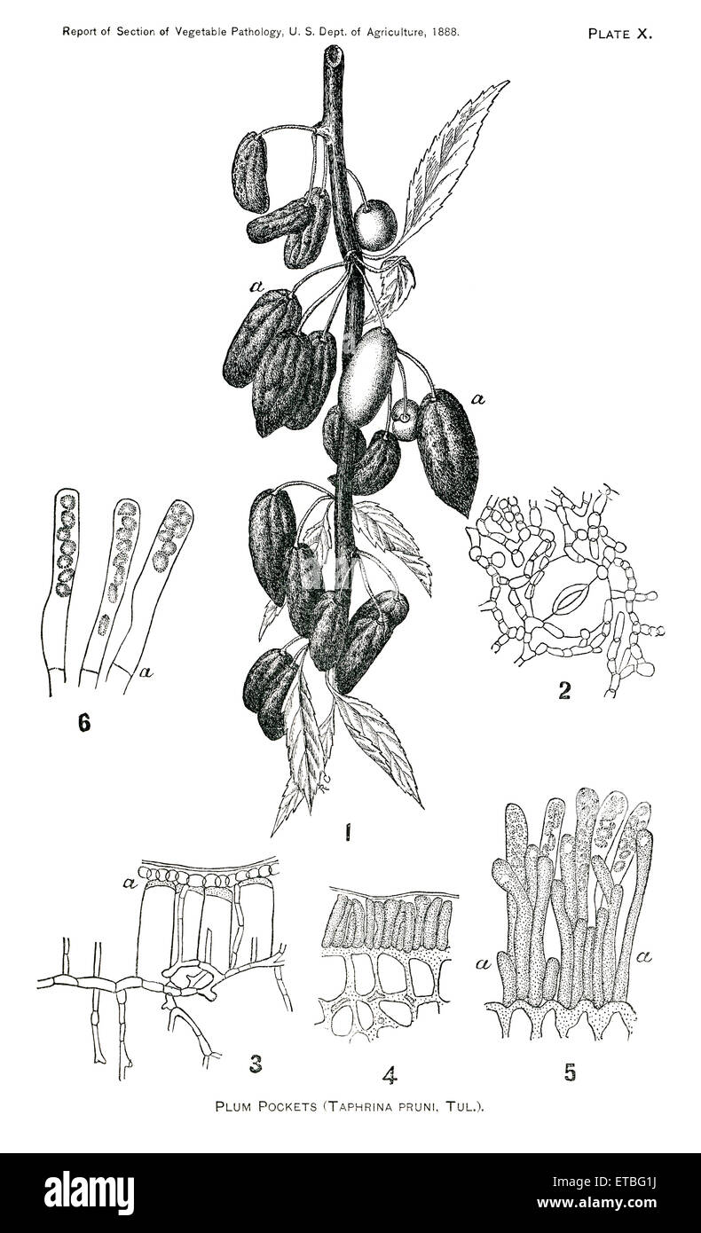 Plum Taschen, Taphrina Pruni Tul., Bericht des Kommissars der Landwirtschaft, US Abteilung der Landwirtschaft, Illustration, 1888 Stockfoto