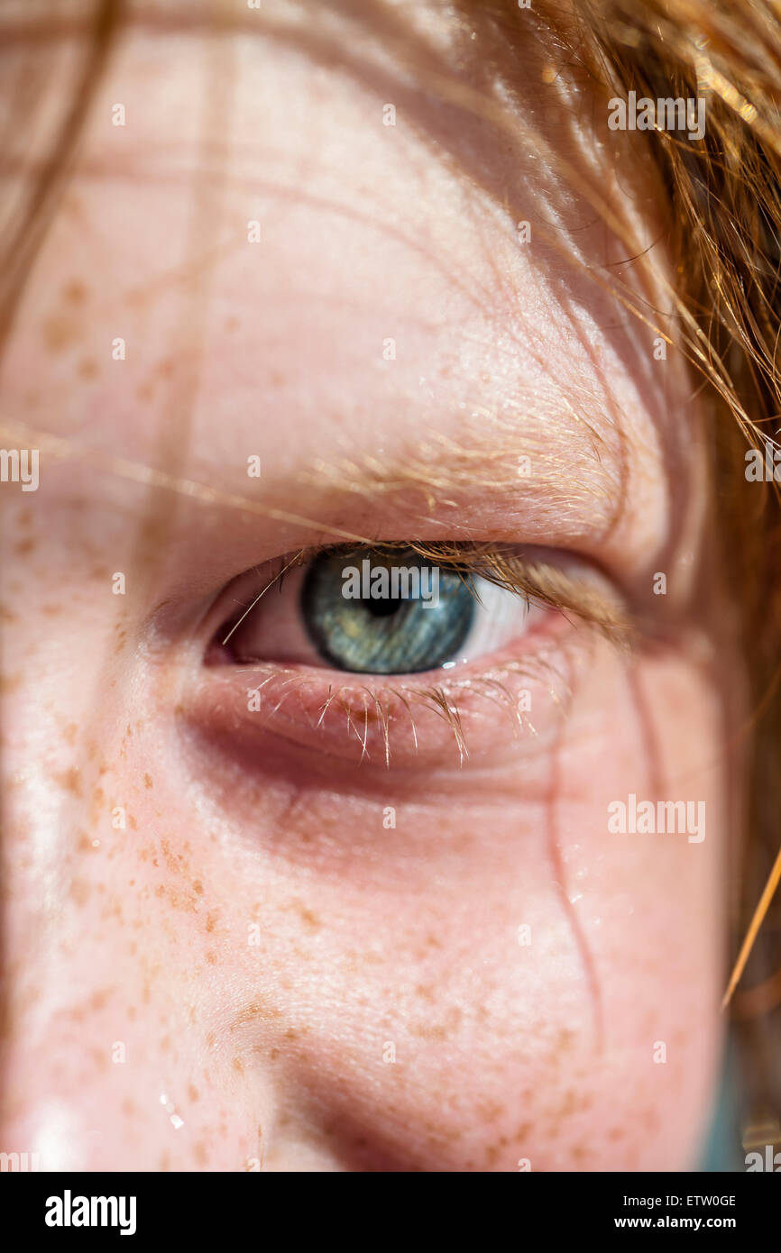 Blaue Augen eines jungen mit Sommersprossen Stockfoto