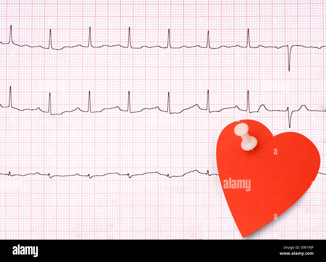 EKG, ekg, Elektrokardiogramm Ausdruck Detail mit Herz geformt Hinweis für Ihre Gesundheit-Nachricht. Stockfoto