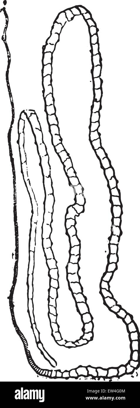 Bandwurm oder Cestoda, graviert Vintage Illustration. Naturgeschichte der Tiere, 1880. Stock Vektor