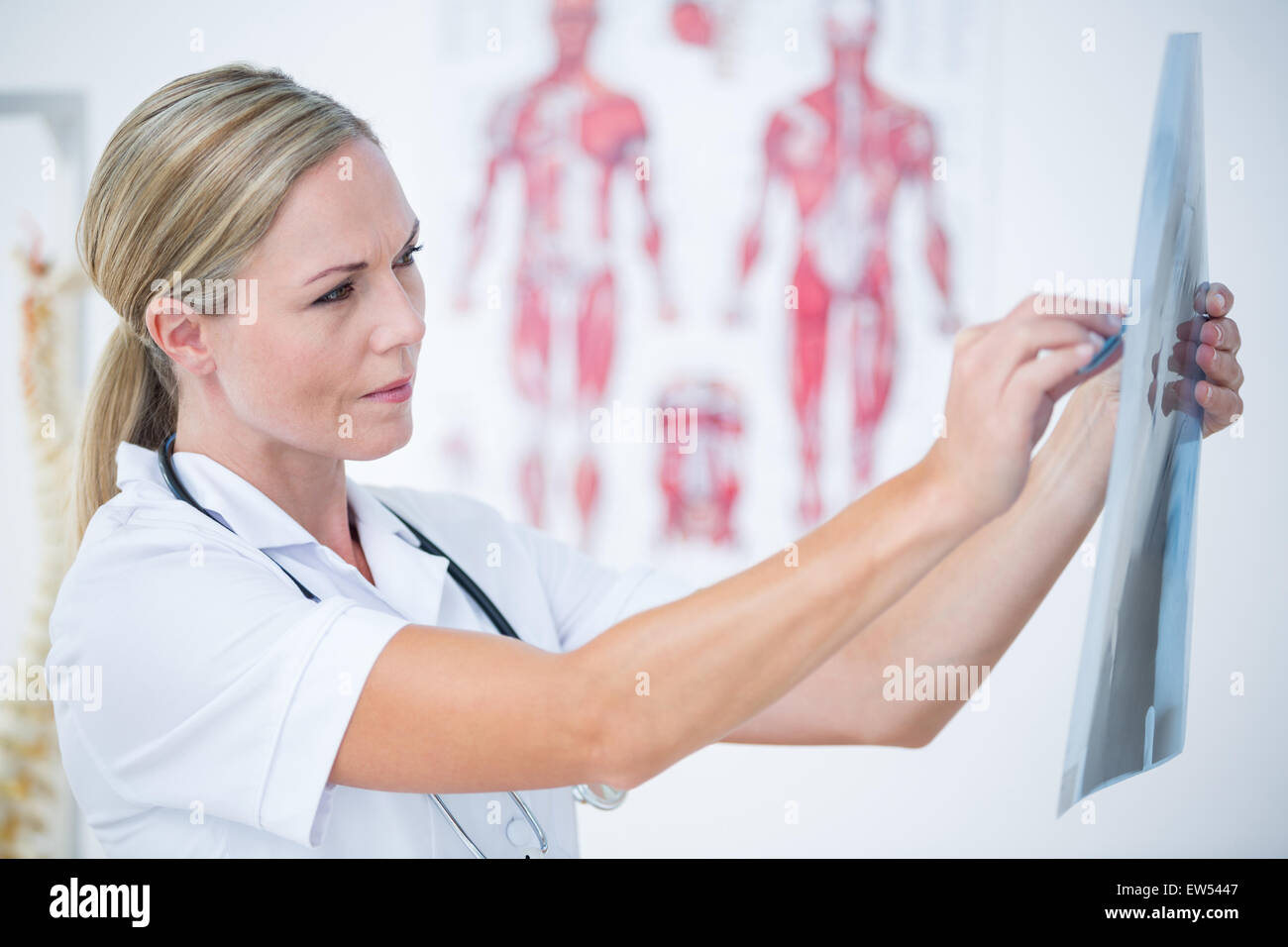 Konzentrat-Arzt Röntgenaufnahmen betrachten Stockfoto