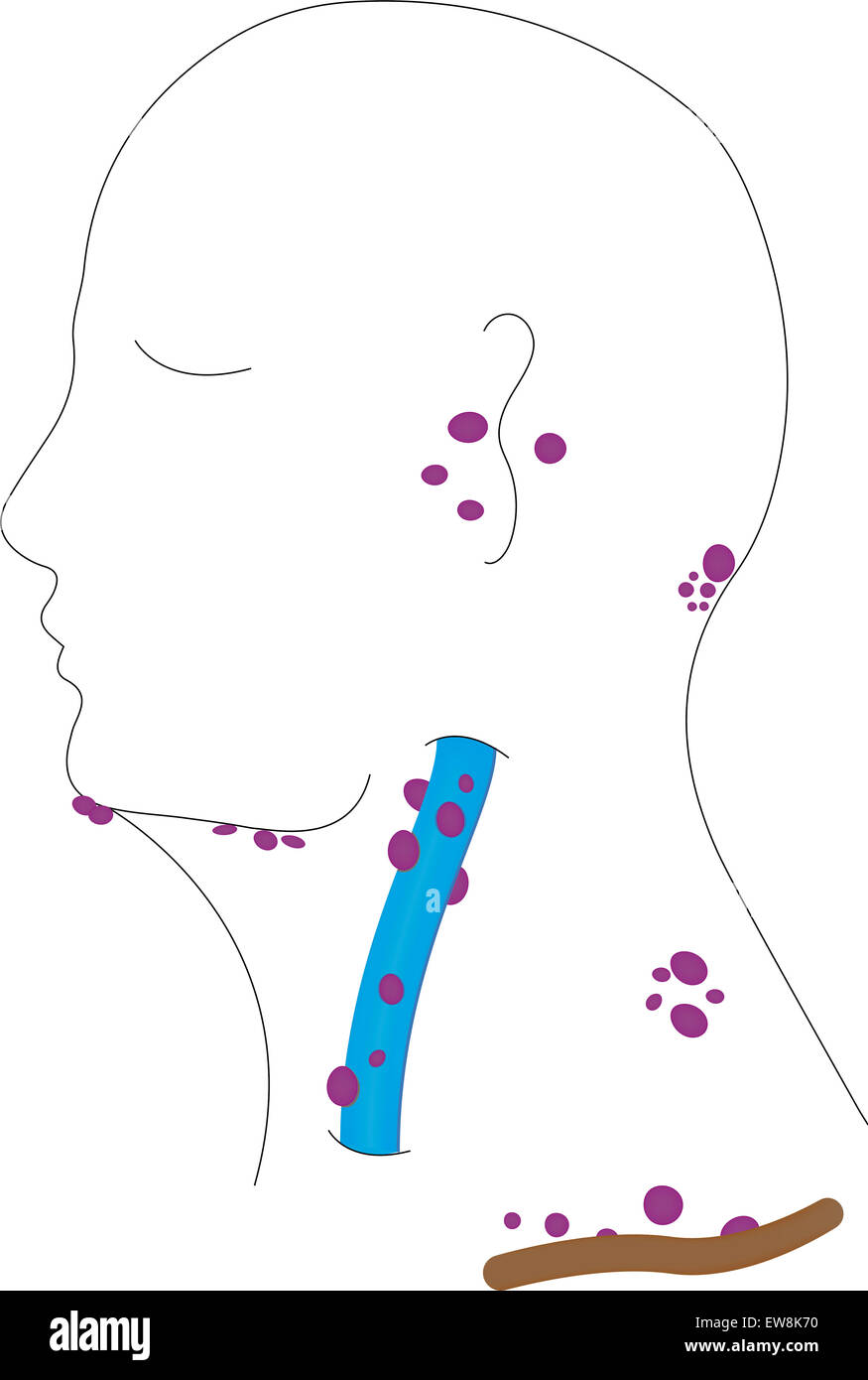 Lymphknoten von Kopf und Hals Stockfoto