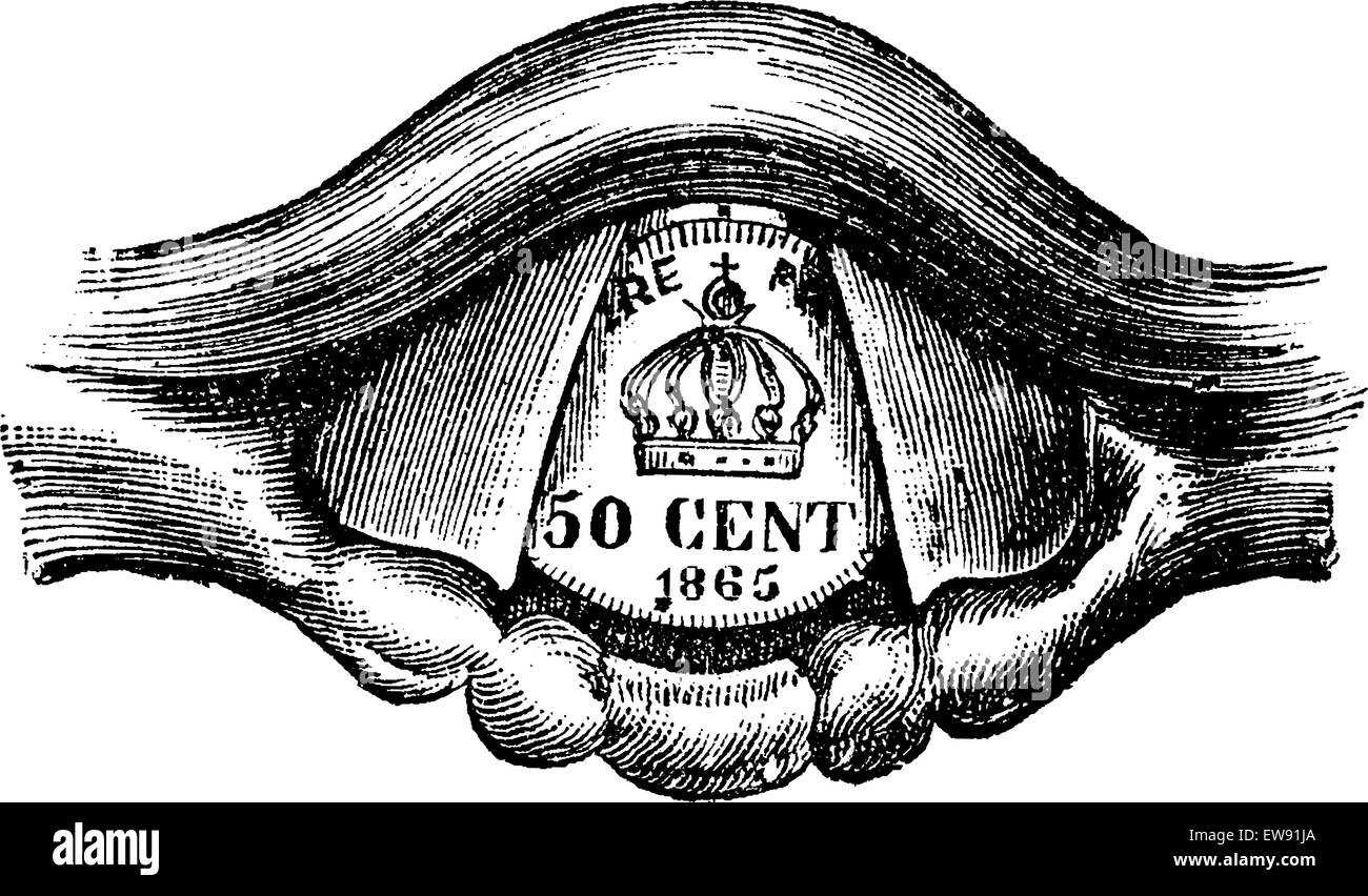 Münze platzierte in den Kehlkopf, graviert Vintage Illustration. Üblichen Medizin Wörterbuch von Dr. Labarthe - 1885 Stock Vektor