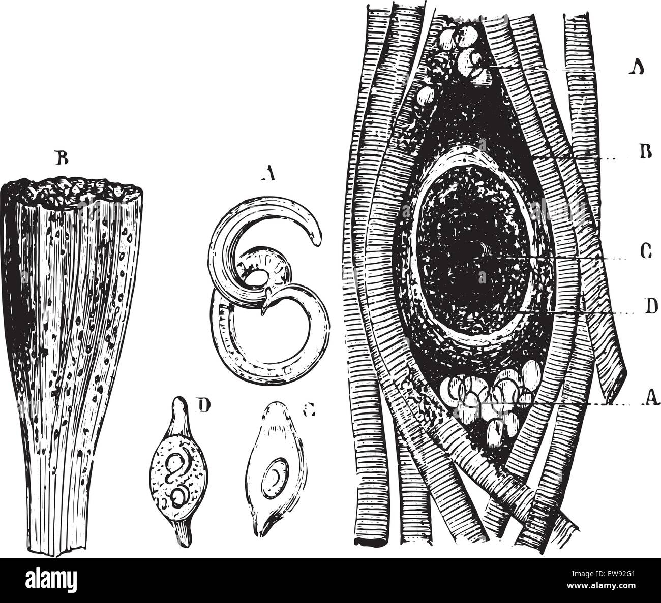 Fig.1210. A. Trichinella isoliert. B. Teil des Muskels Angriff mit Trichinen. C, D. Zysten, die eine Trichin enthalten. A. Cy Fig.1211. Stock Vektor