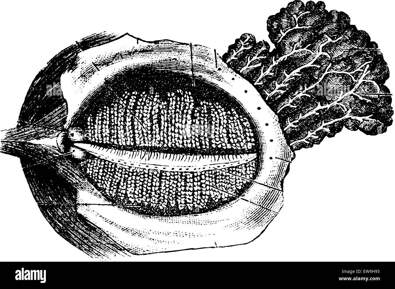 Tiefe Oberfläche des menschlichen Augenlids mit der Nasolacrimal Drüse, graviert Vintage Illustration. Üblichen Medizin Wörterbuch von Dr. Lab Stock Vektor