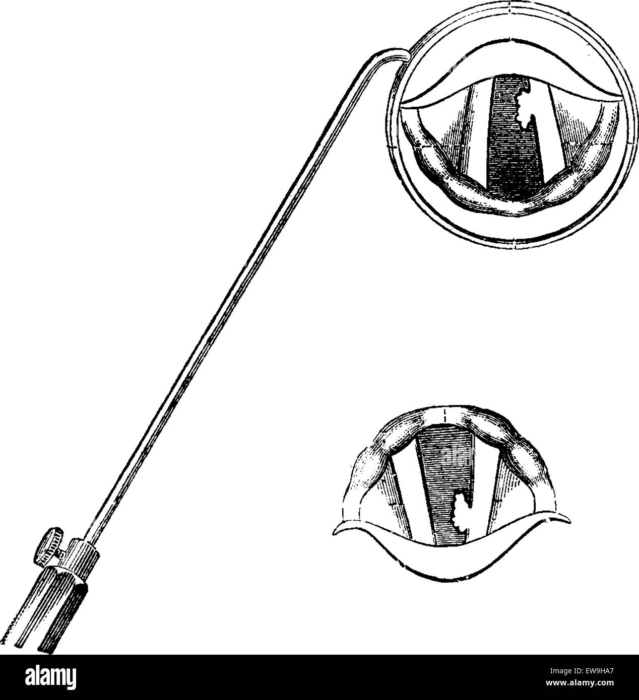 Teile des Kehlkopfes, gesehen durch einen Kehlkopf Spiegel graviert Vintage Illustration. Üblichen Medizin Wörterbuch von Dr. Labarthe Stock Vektor