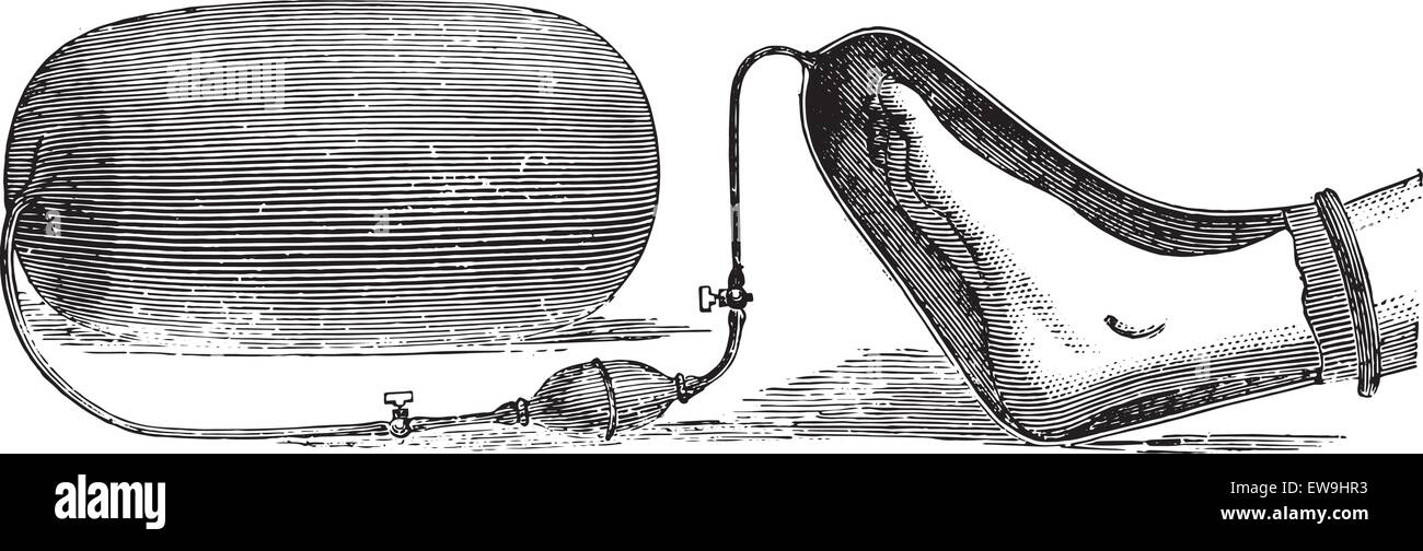 Ein Apparat für die Anwendung von Sauerstoff auf einer Extremität Gangrän, graviert Vintage Illustration. Üblichen Medizin Wörterbuch - Paul L Stock Vektor