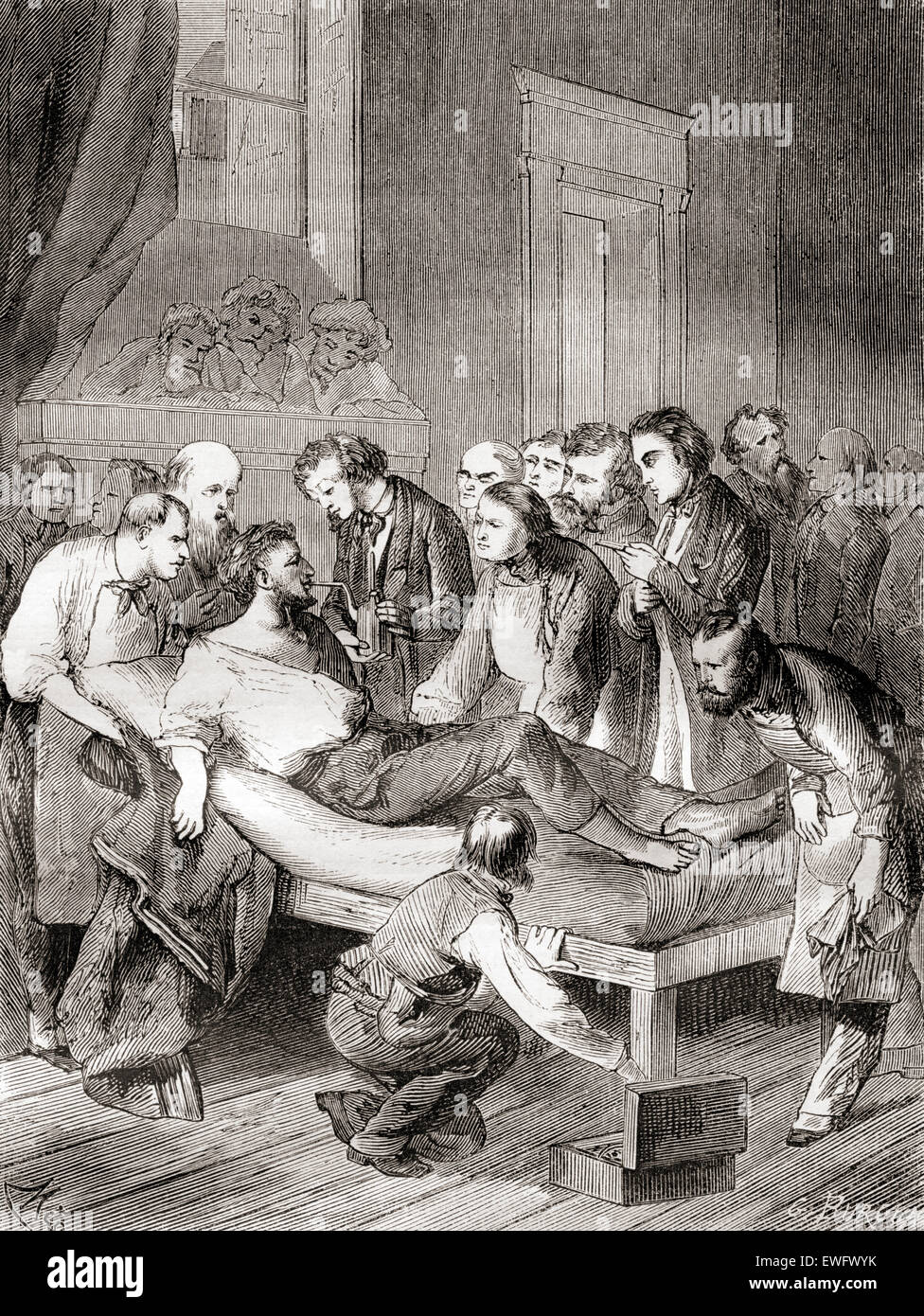 Die erste öffentliche Demonstration des Einsatzes von inhalativen Äther als eine chirurgische Anästhesie 1846 durch eine amerikanische Zahnarzt William Thomas Green Morton (1819 – 1868). Stockfoto