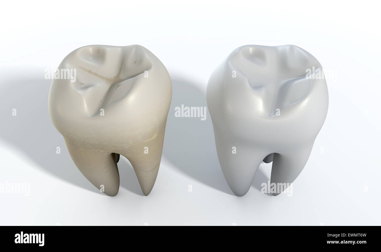 Ein Vergleich zwischen einer gefärbten schmutzigen Zahn und einen sauberen weißen Zahn auf eine isolierte Studio-Hintergrund Stockfoto