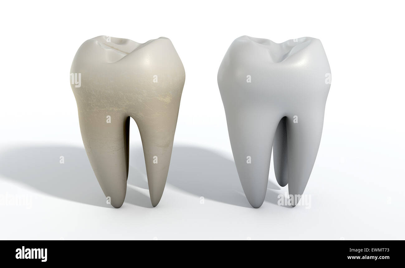 Ein Vergleich zwischen einer gefärbten schmutzigen Zahn und einen sauberen weißen Zahn auf eine isolierte Studio-Hintergrund Stockfoto