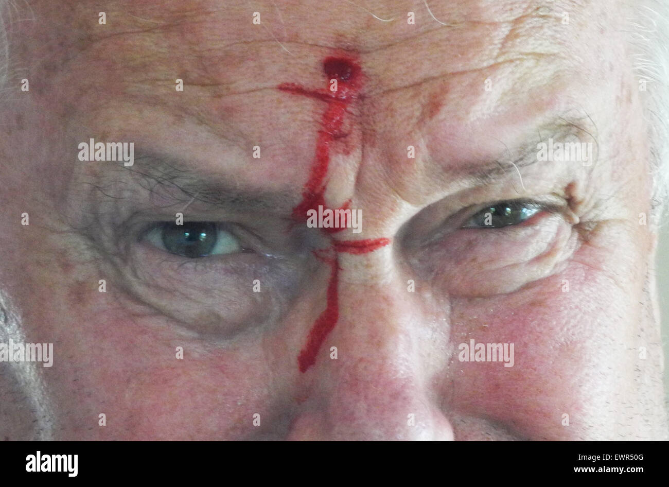 Fehlschüsse Schußwunde Kopf Blutungen schießen Verletzungen Waffe - Modell RELEASE veröffentlicht Stockfoto
