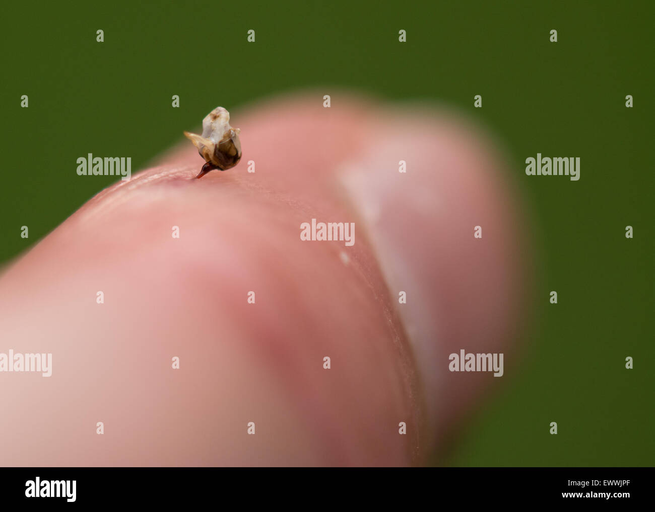 Honig Biene (Apis) Stinger - zusammen mit Teil des Verdauungstraktes und Nerven und Muskeln - in einem menschlichen finger Stockfoto