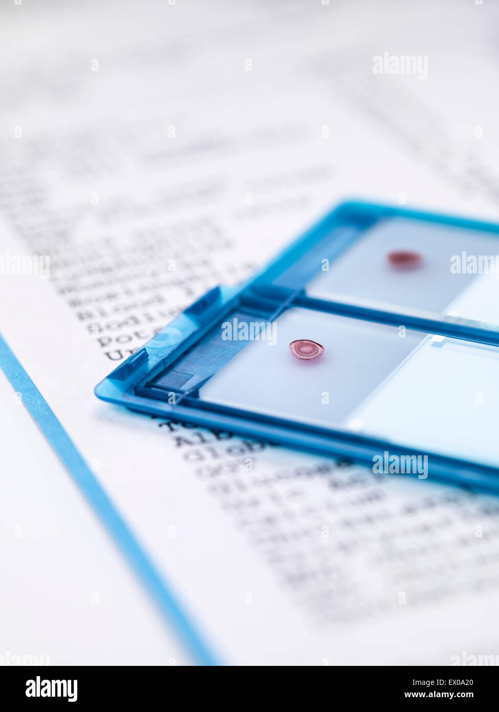 Blutproben auf Mikroskop schieben Sie sitzen auf Ergebnisse Stockfoto