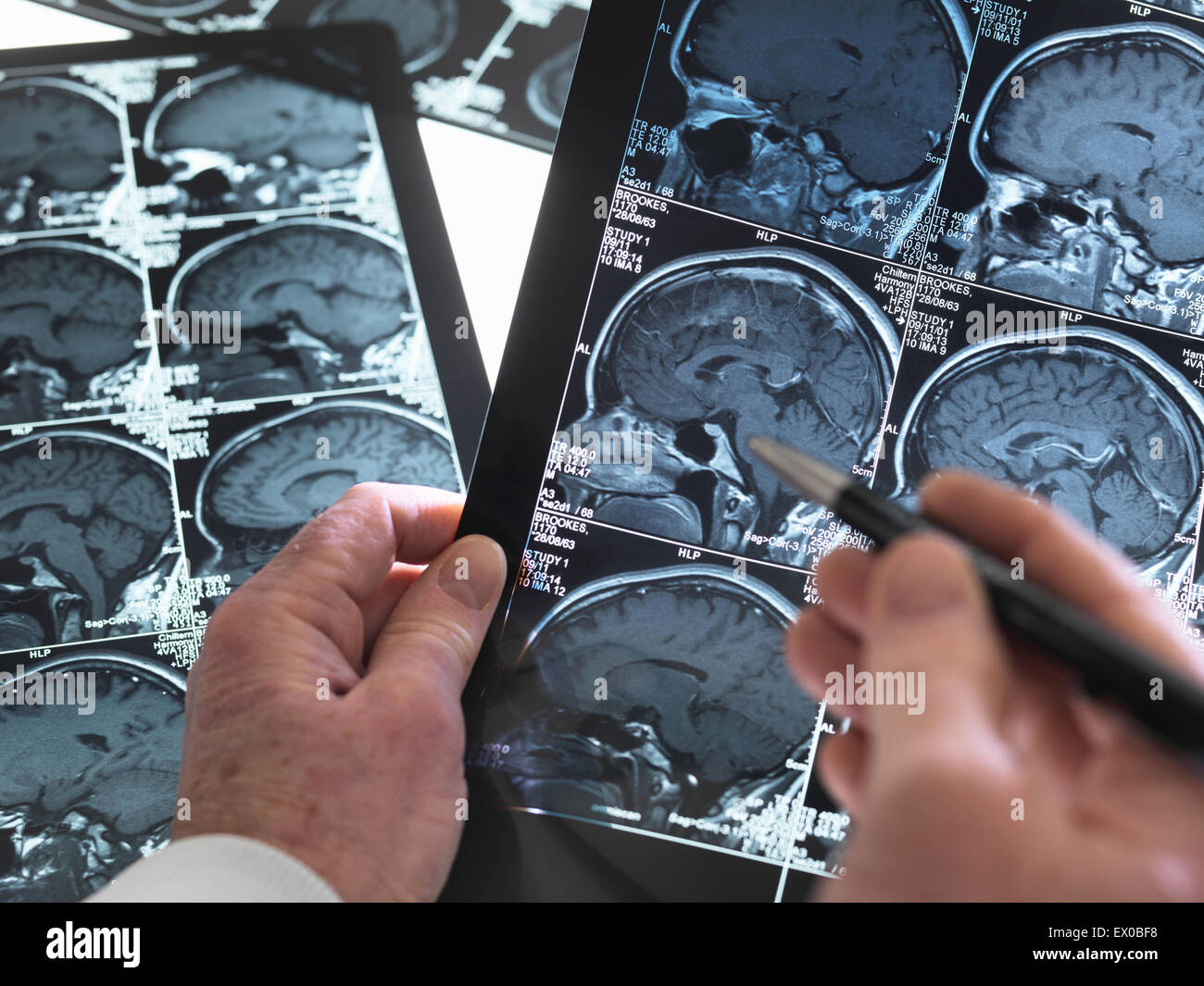 Nahaufnahme von Arzt anzeigen einen gesunden Gehirn-scan Stockfoto