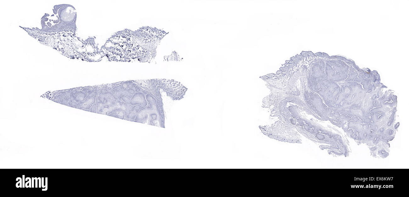 Histon H3 (Ser10)-Maus: Immunoperoxidase Färbung Formalin fixiert, Paraffin-eingebetteten Maus Papilloma Haut nuklearen Färbung der mitotischen Zellen. Stockfoto