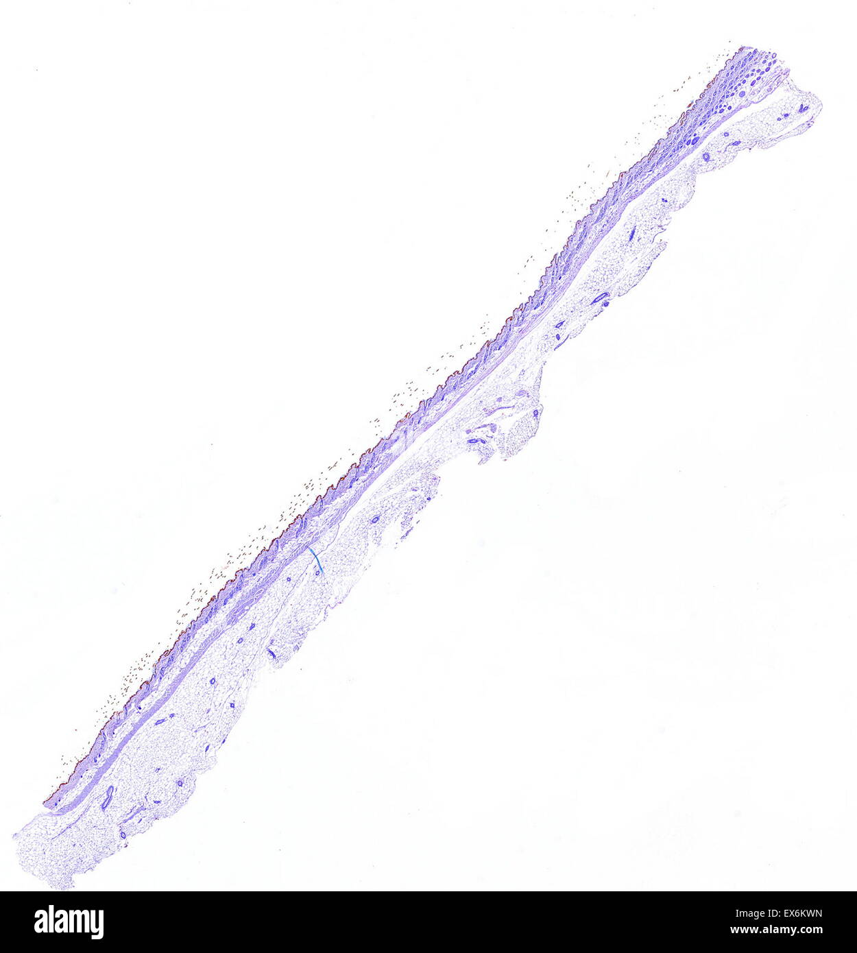 Cytokeratin 1: Immunoperoxidase Färbung von Formalin fixiert, Paraffin-eingebetteten Maus Haut zeigen Zytoplasma Färbung in der epidermis Stockfoto