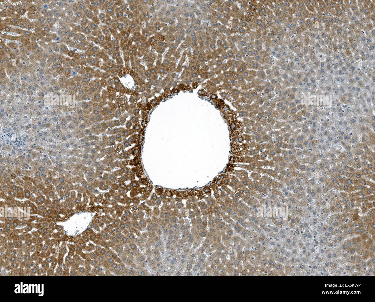 Immunoperoxidase Färbung von Formalin fixiert, Paraffin eingebettet, TCDD behandelt Ratte Leber zeigt eine Centrilobular Zytoplasma der Hepatozyten Färbung. Stockfoto