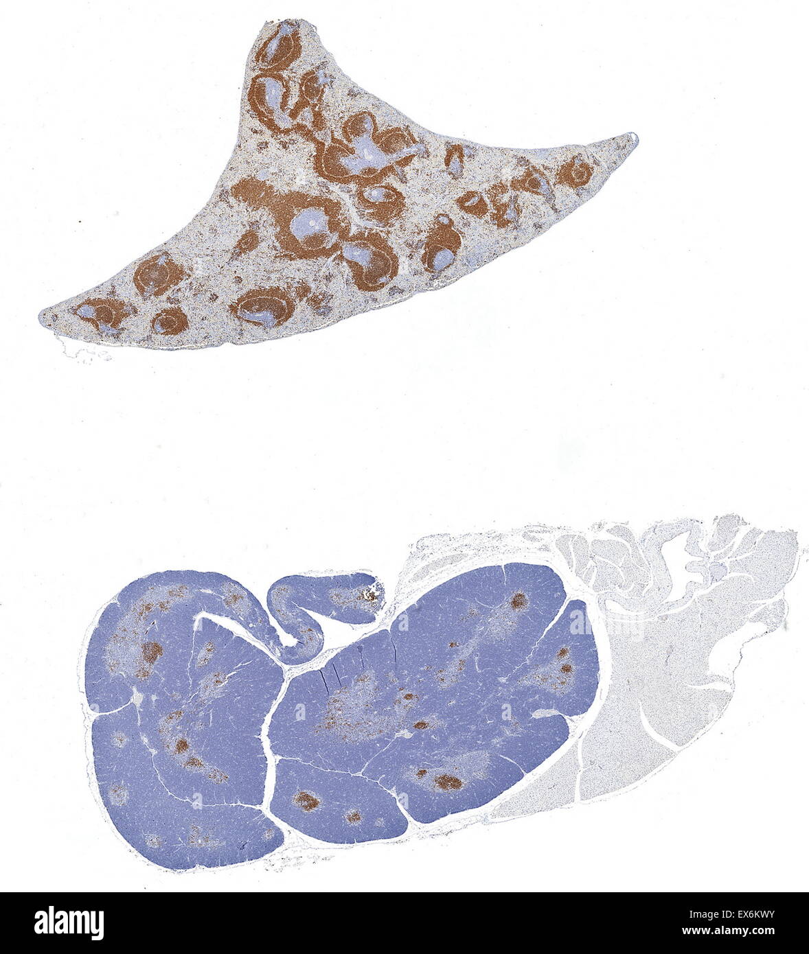 CD79a: Immunoperoxidase Färbung des Formalin fixiert, Paraffin-eingebetteten Maus Milz und Thymus zeigt Zellmembran Färbung in den Β-Zellen Stockfoto