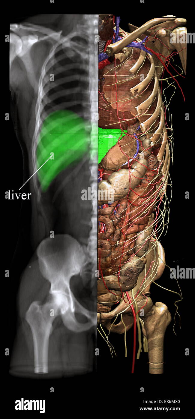 Verschiedene Ansichtsmodi wie Röntgenaufnahmen können aus jeder Richtung und für jeden Teil des Bildes gewählt werden. Das Röntgenbild kann abgefragt werden, um welches Objekt auf dem Bild trägt. Stockfoto