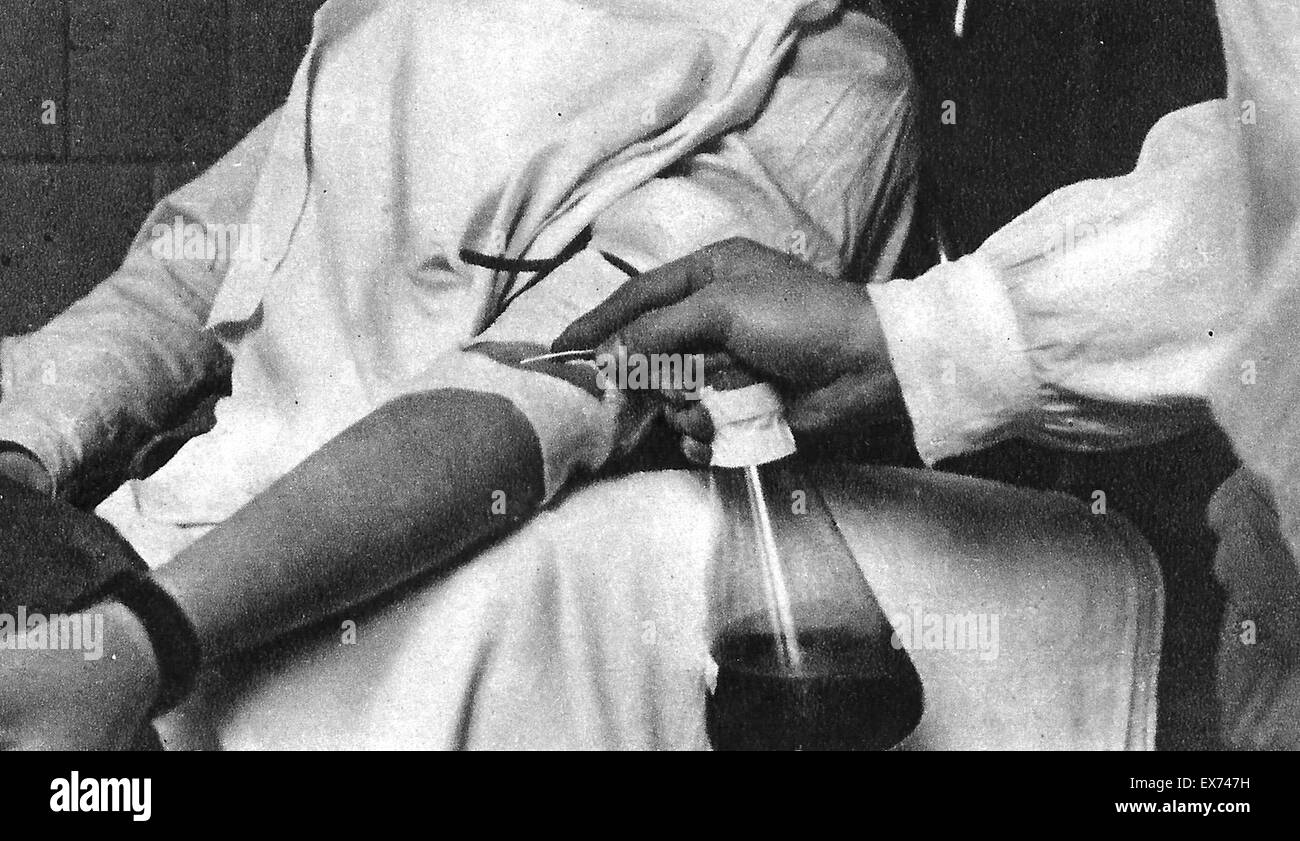 Den spanischen Bürgerkrieg markiert eine neue Ära in der Bluttransfusion Medizin. Frederic Duran Jordà und Carlos Elósegui Sarasoles, Direktoren, bzw. der Bluttransfusionsdienste der republikanischen Armee und der aufständischen Truppen waren Innovatoren in der Stockfoto