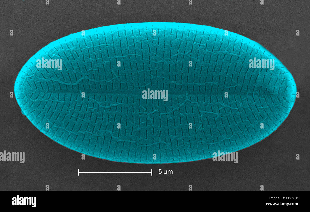Scanning Electron Schliffbild zeigt eine Diatomee Stockfoto