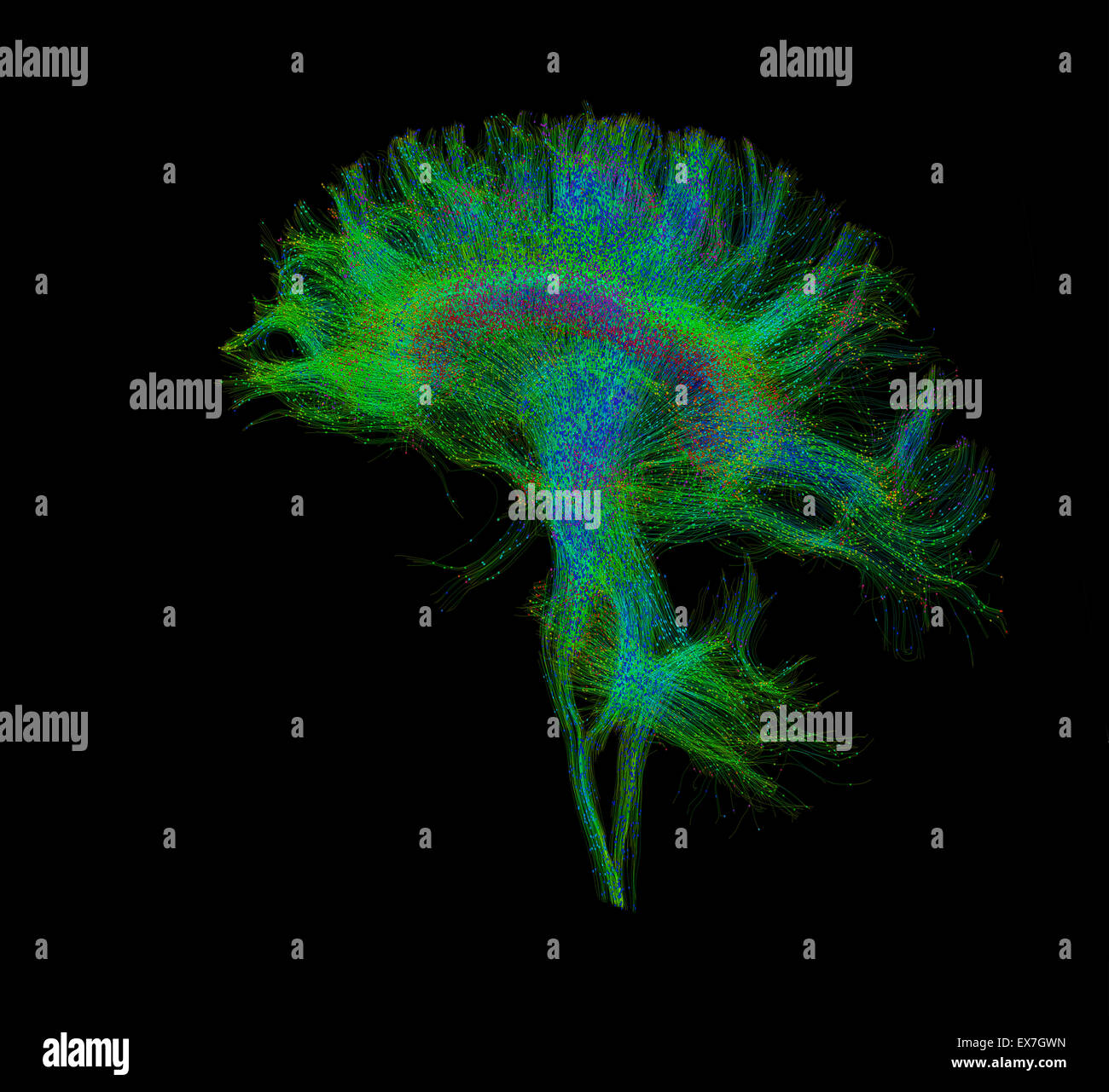 Faser Traktographie Bild des menschlichen Gehirns Stockfoto