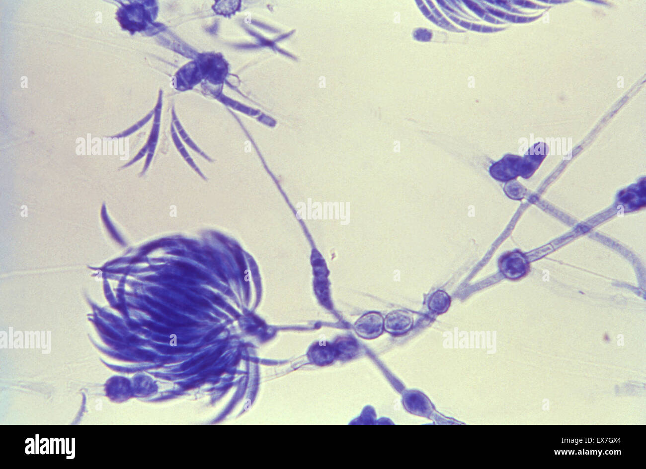 Lactophenol Baumwolle blau gefärbten Fusarium pilzlichen Organismus. Stockfoto
