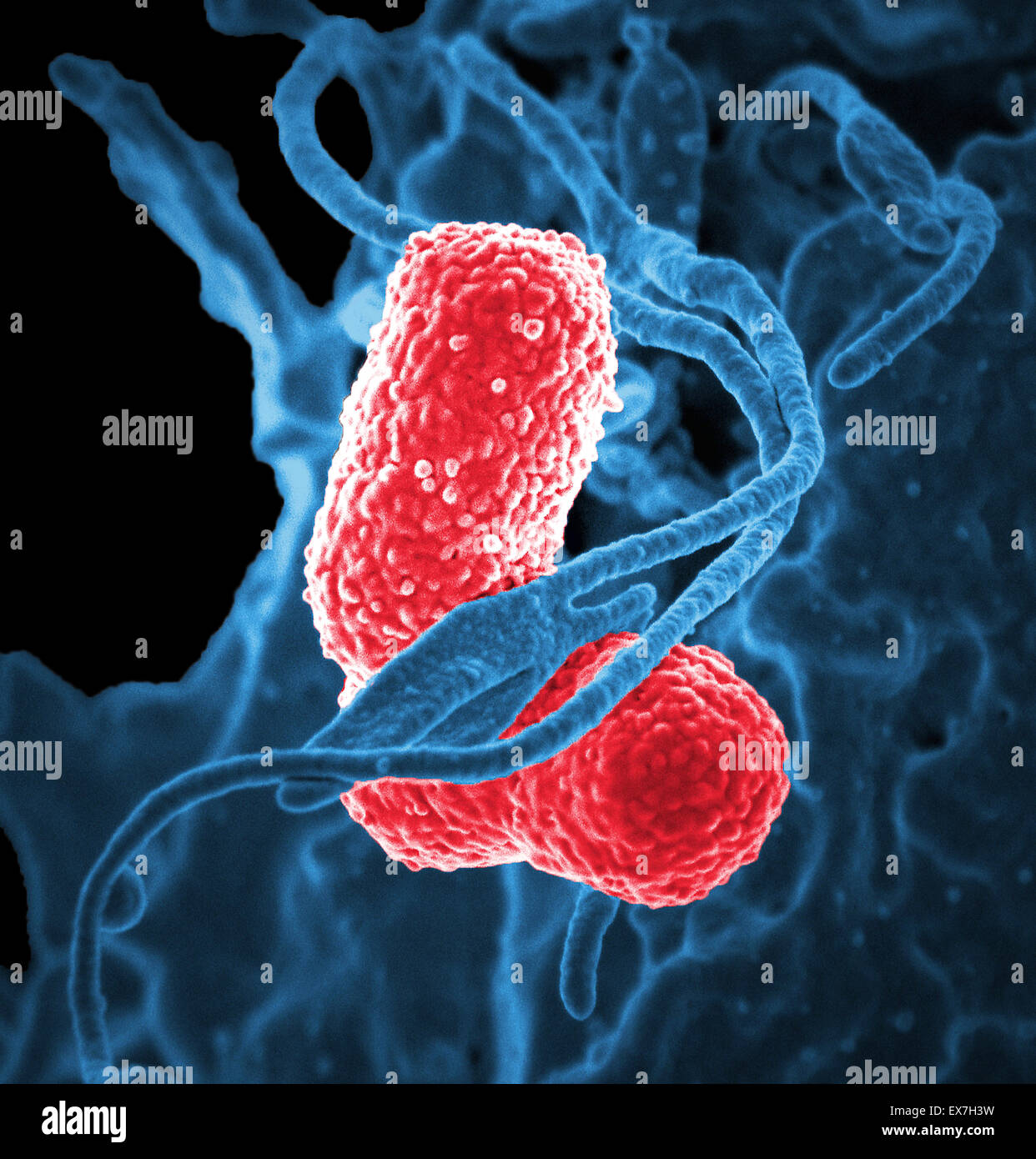 Scanning Electron Schliffbild einer menschlichen Neutrophilen Leukozyten und Klebsiella Bakterien. Stockfoto