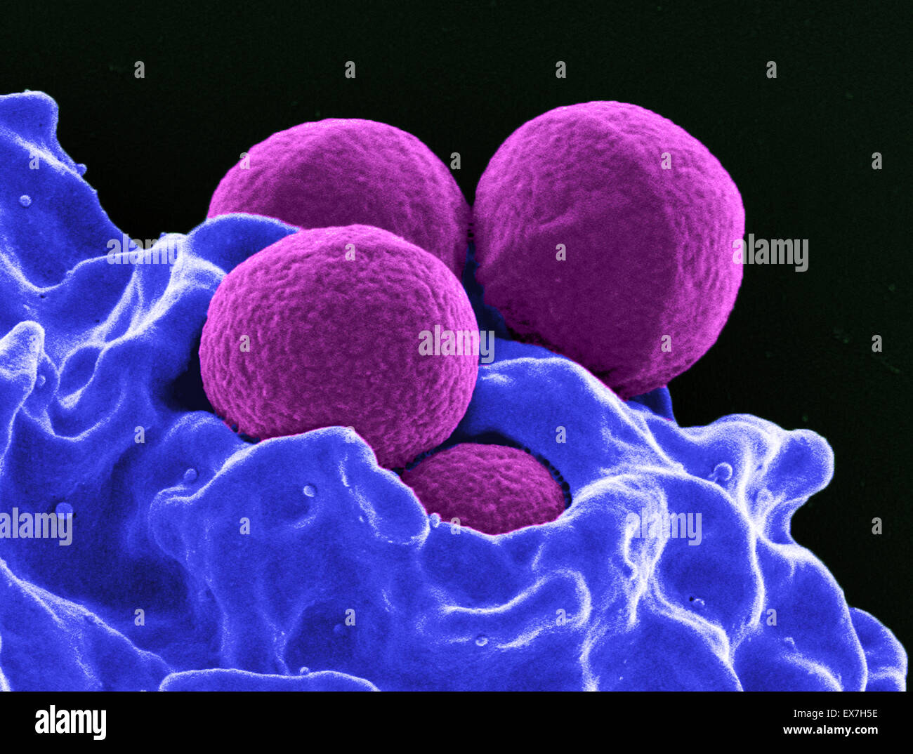 Eingefärbte scanning Electron Schliffbild (SEM) von vier Runden Methicillin-resistenten Staphylococcus Aureus (MRSA) Keimen. Stockfoto