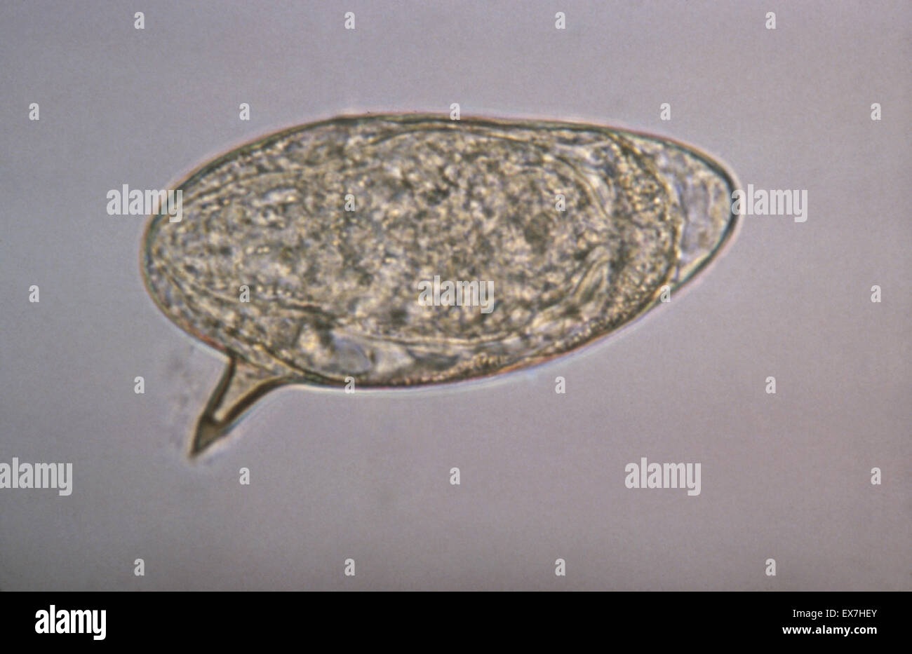 Schistosoma Mansoni Ei mit seitlichen Wirbelsäule. Stockfoto