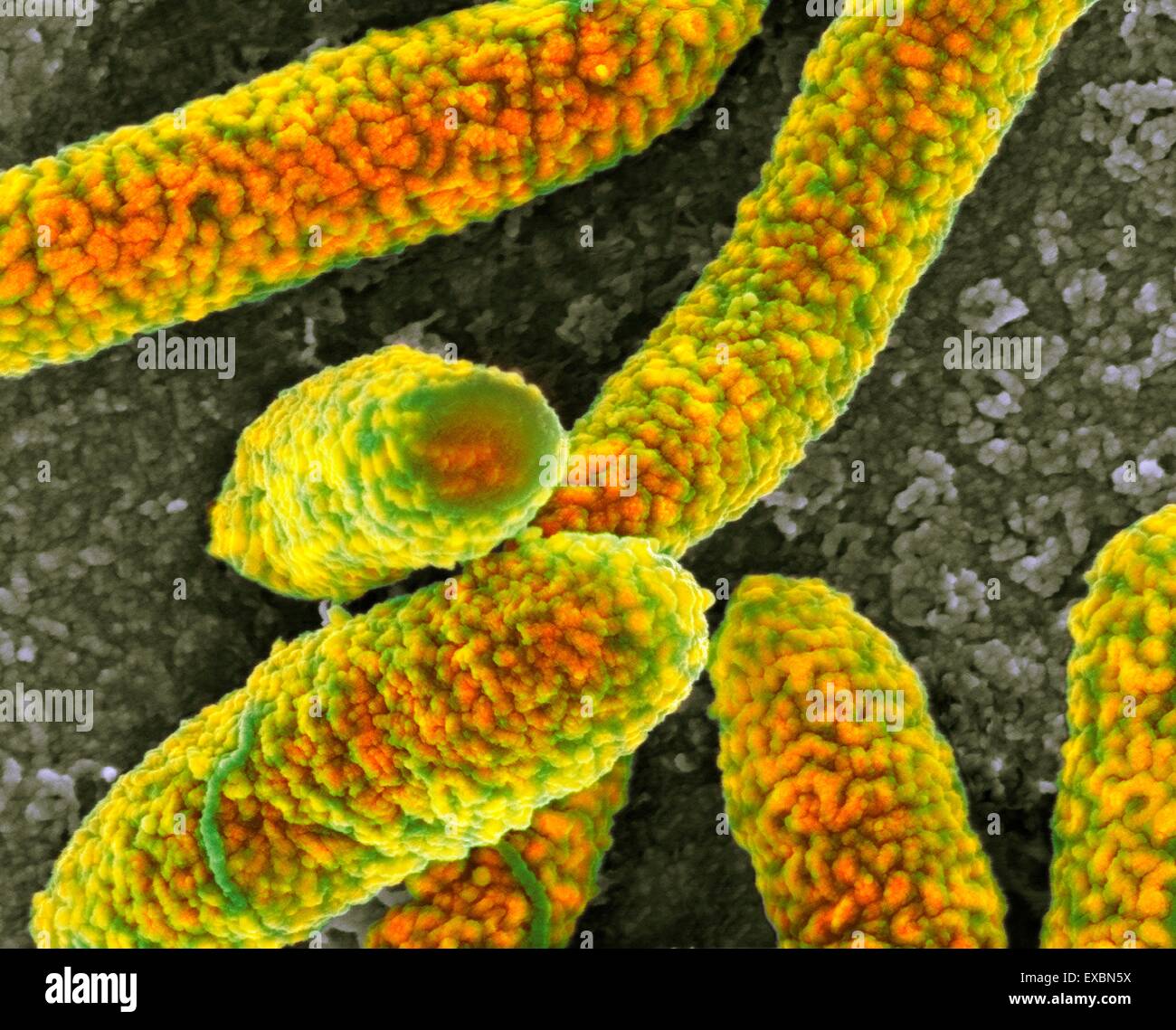 Farbige scanning Electron Schliffbild (SEM) von Escherichia-coli-Bakterien. Vergrößerung: X27, 800 wenn bei 10 Zentimeter gedruckt Stockfoto