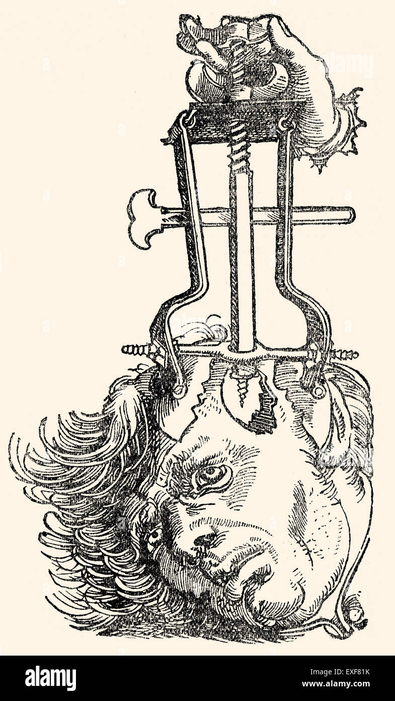 Zerspant, Trepanation Bohrlochs, Holzschnitt aus "Feldtbuch der Wundartzney" von Hans von Gersdorff, Straßburg, Deutschland, 1528, Stockfoto