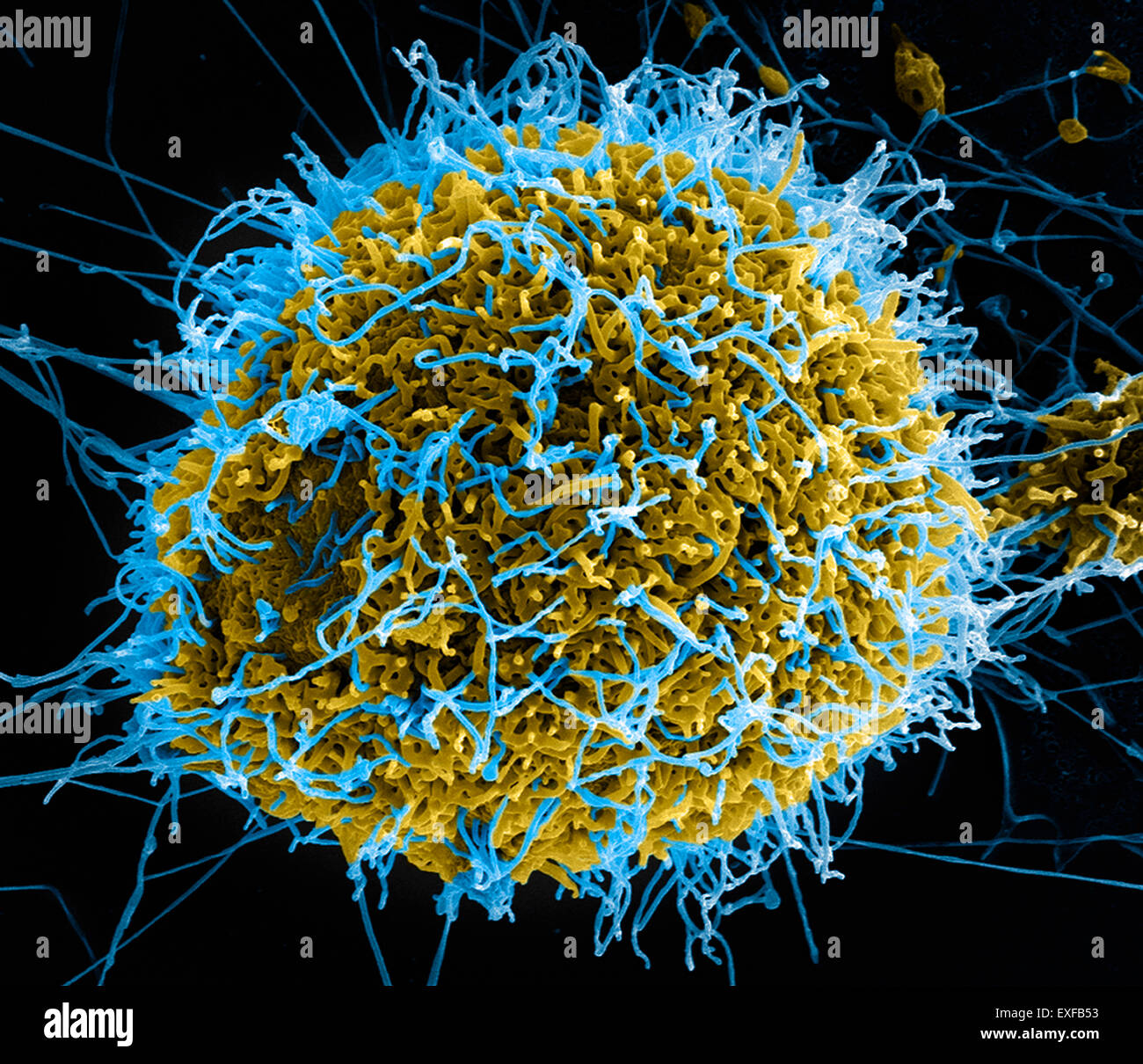 Filamentösen Ebola-Virus-Partikel (farbige blau) angehende aus einer chronisch-infizierten VERO E6 Zelle (farbige gelb) Stockfoto