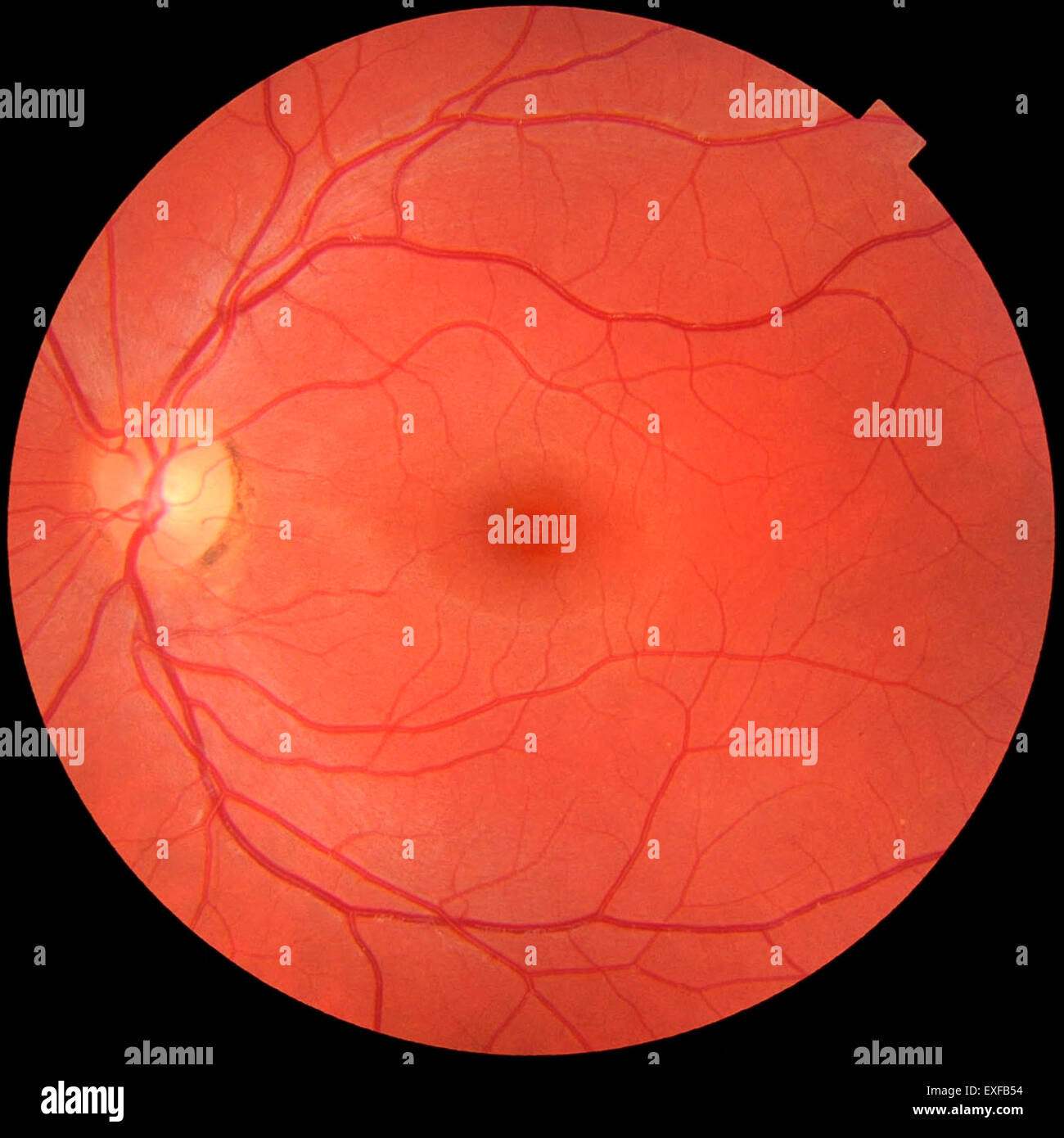 Augenhintergrundes Foto von normalen linkes Auge. Makula im Center, optische Datenträger wo Blutgefäße konvergieren, Pigmentierung am Rand Stockfoto