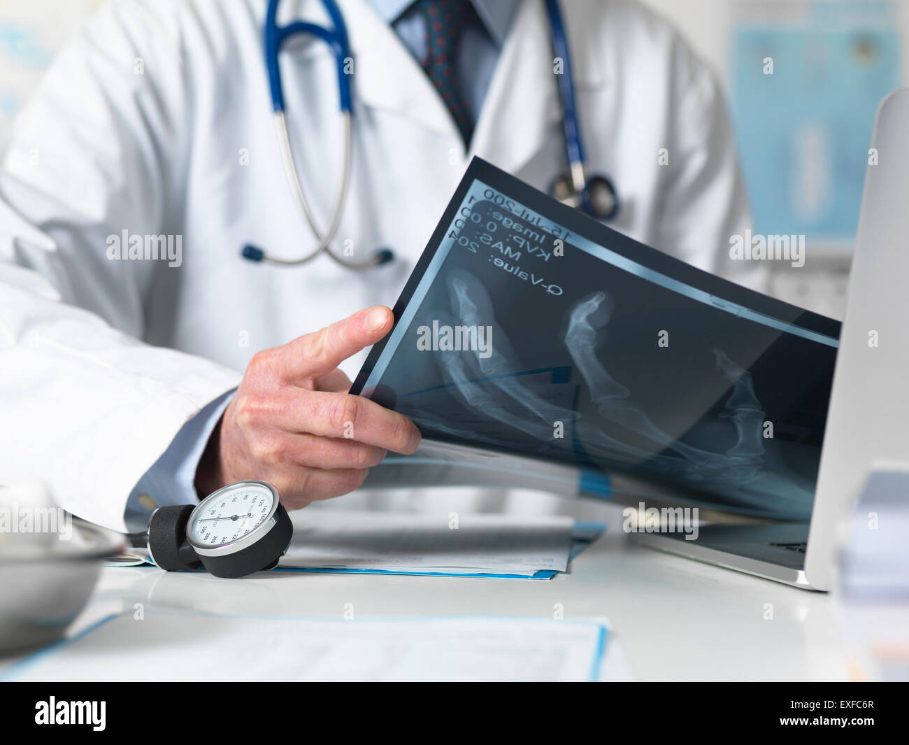 Schuss des Arztes anzeigen Röntgen Hand in Klinik beschnitten Stockfoto