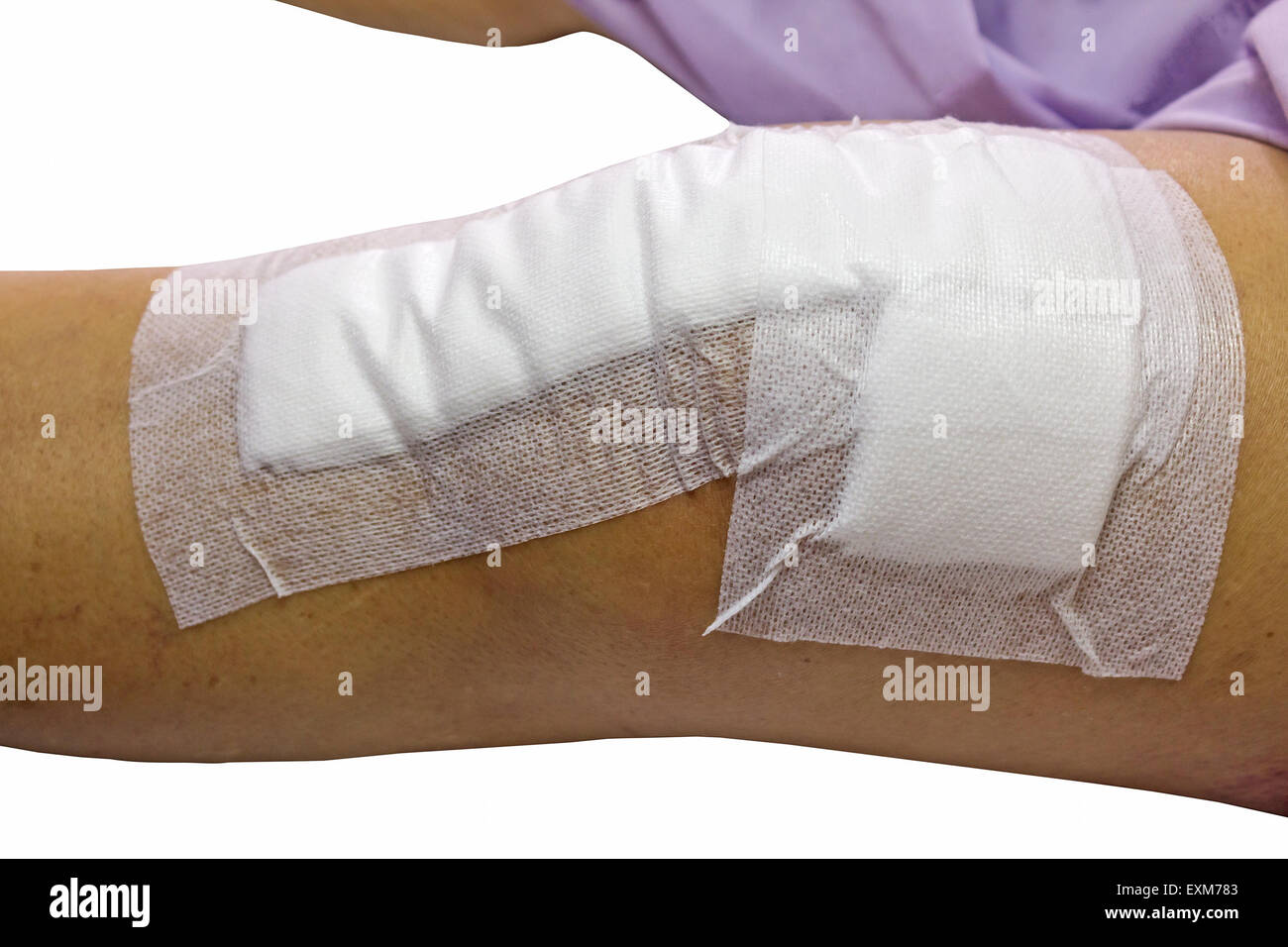 Kniegelenkersatz-Operation nach der Operation Patienten senior Frau (60er Jahre) auf dem Bett im Krankenhaus isoliert auf weißem Hintergrund Stockfoto