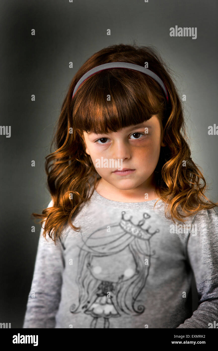 Porträt des jungen Mädchens mit einem Bluterguss oder blaues Auge auf ihrer linken Seite. Dies ist ein Modell, Modell veröffentlicht. Vertikale Farbfoto Stockfoto