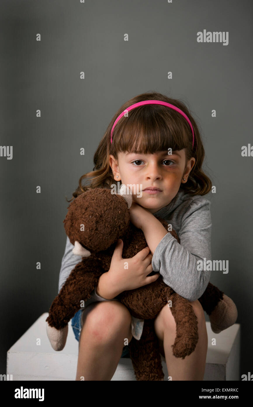 Porträt des jungen Mädchens mit einem Bluterguss oder blaues Auge auf ihrer linken Seite. Dies ist ein Modell, Modell veröffentlicht. Vertikale Farbfoto Stockfoto